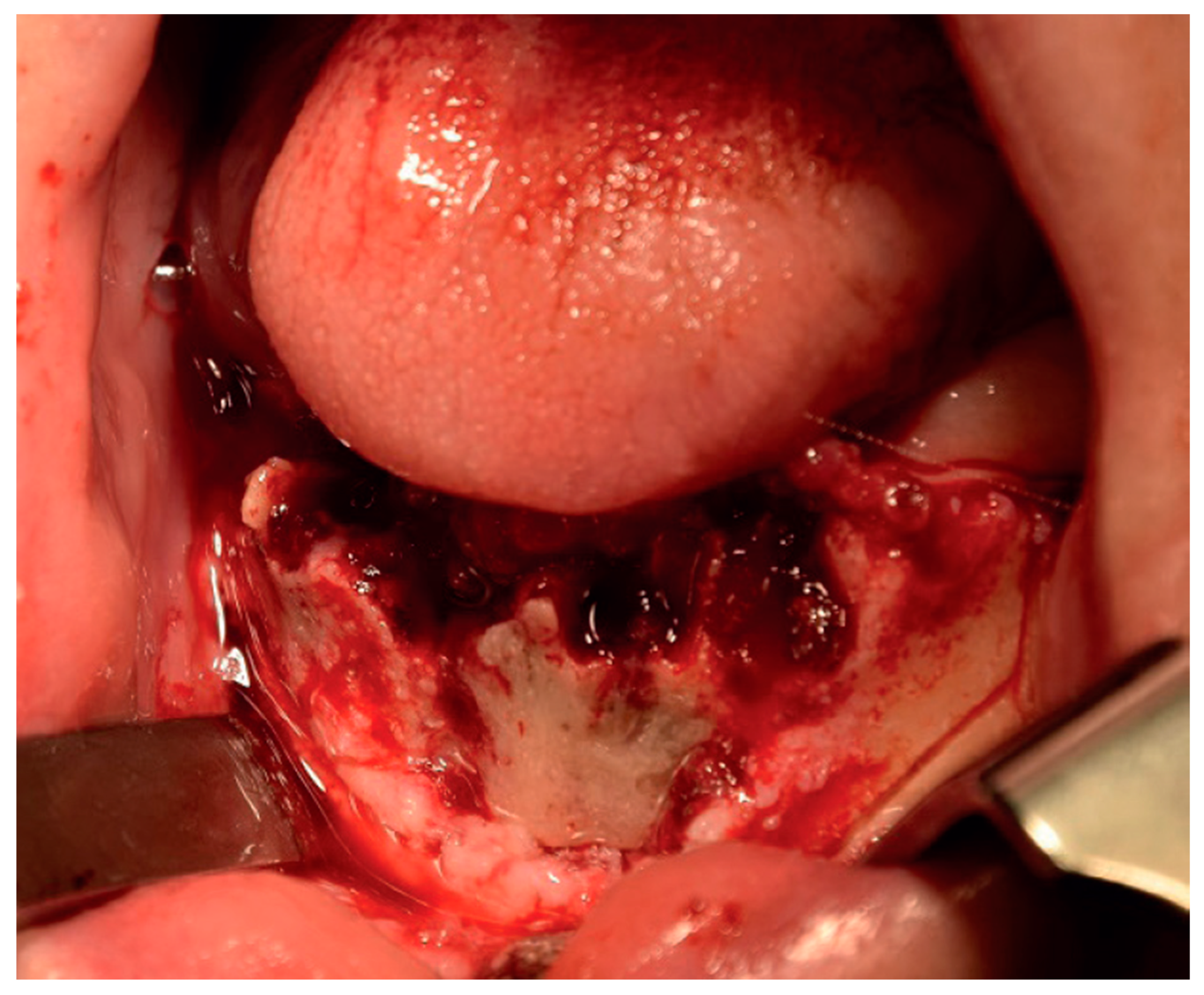 Surgeries 03 00016 g004 Surgeries 03 00016 g004