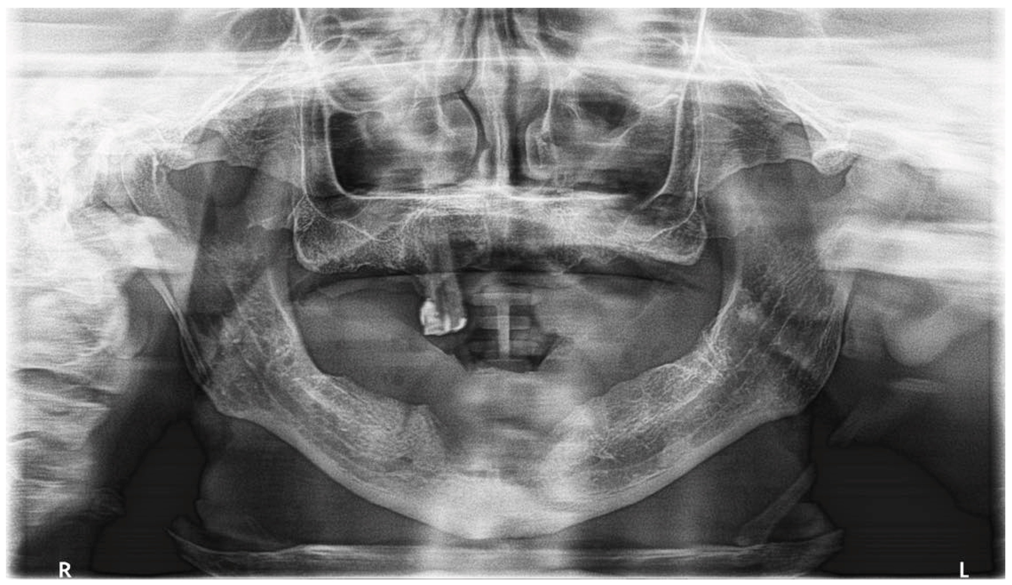Surgeries 03 00016 g005 Surgeries 03 00016 g005