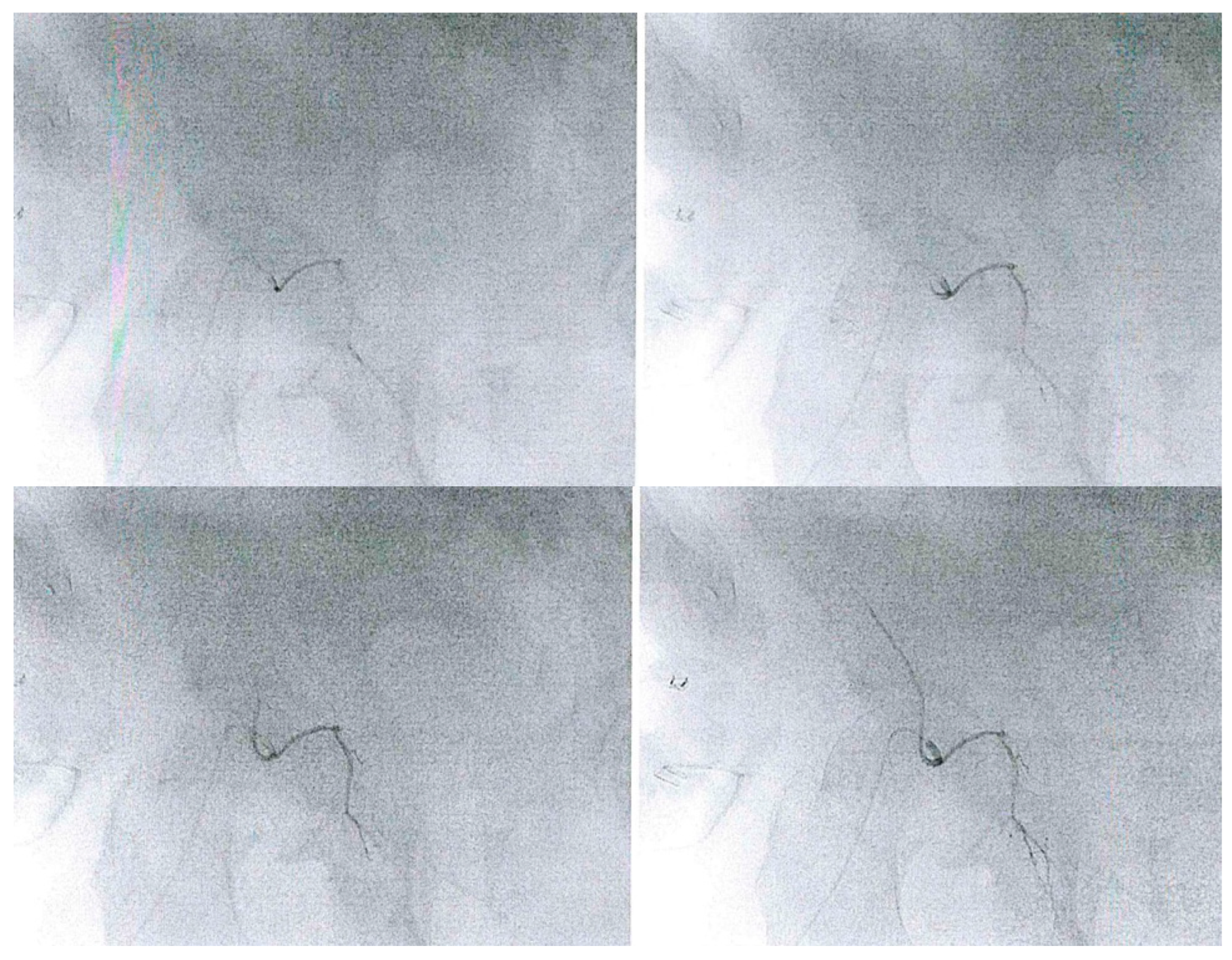 Surgeries 03 00025 g003 550