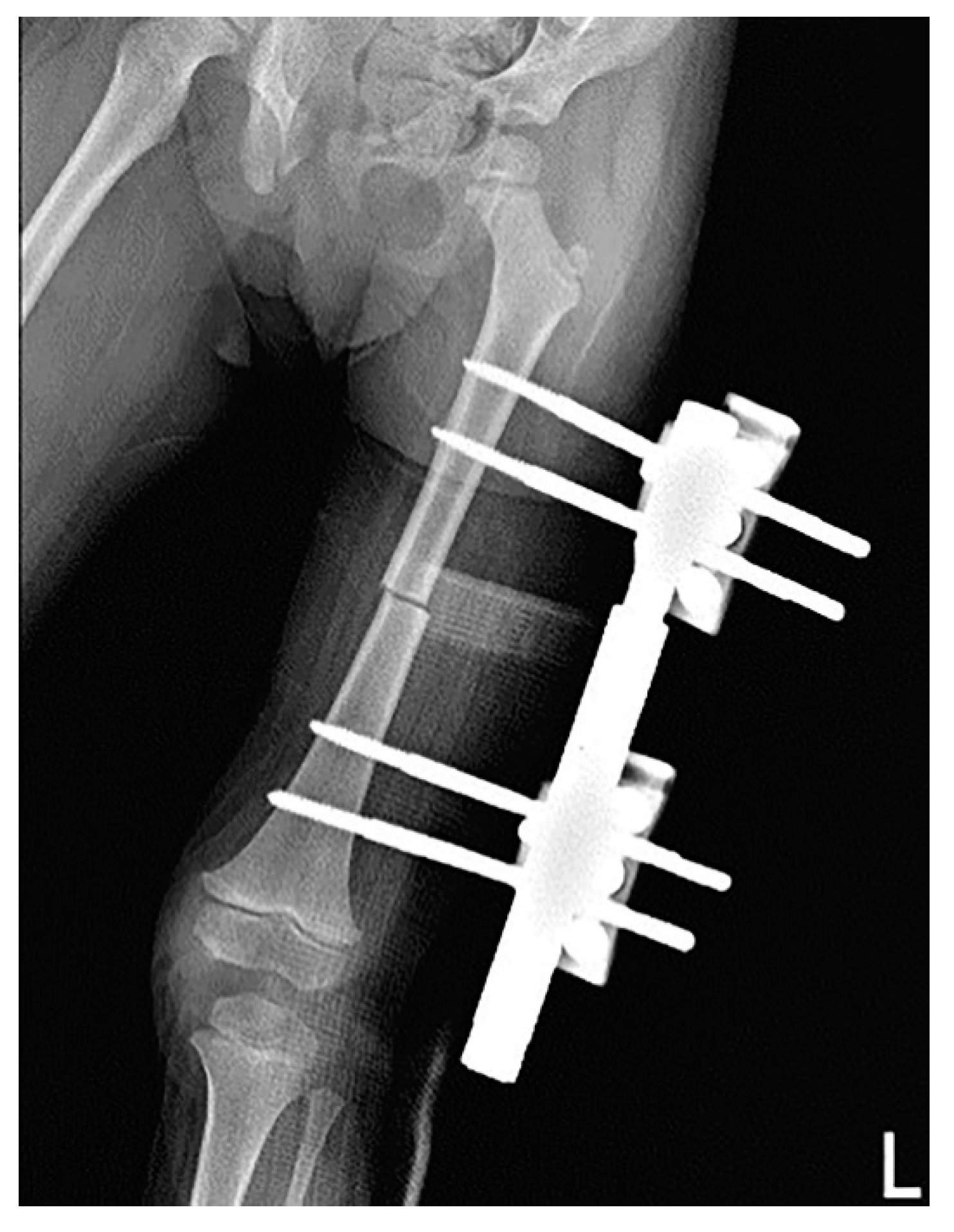 Surgeries 03 00026 g003