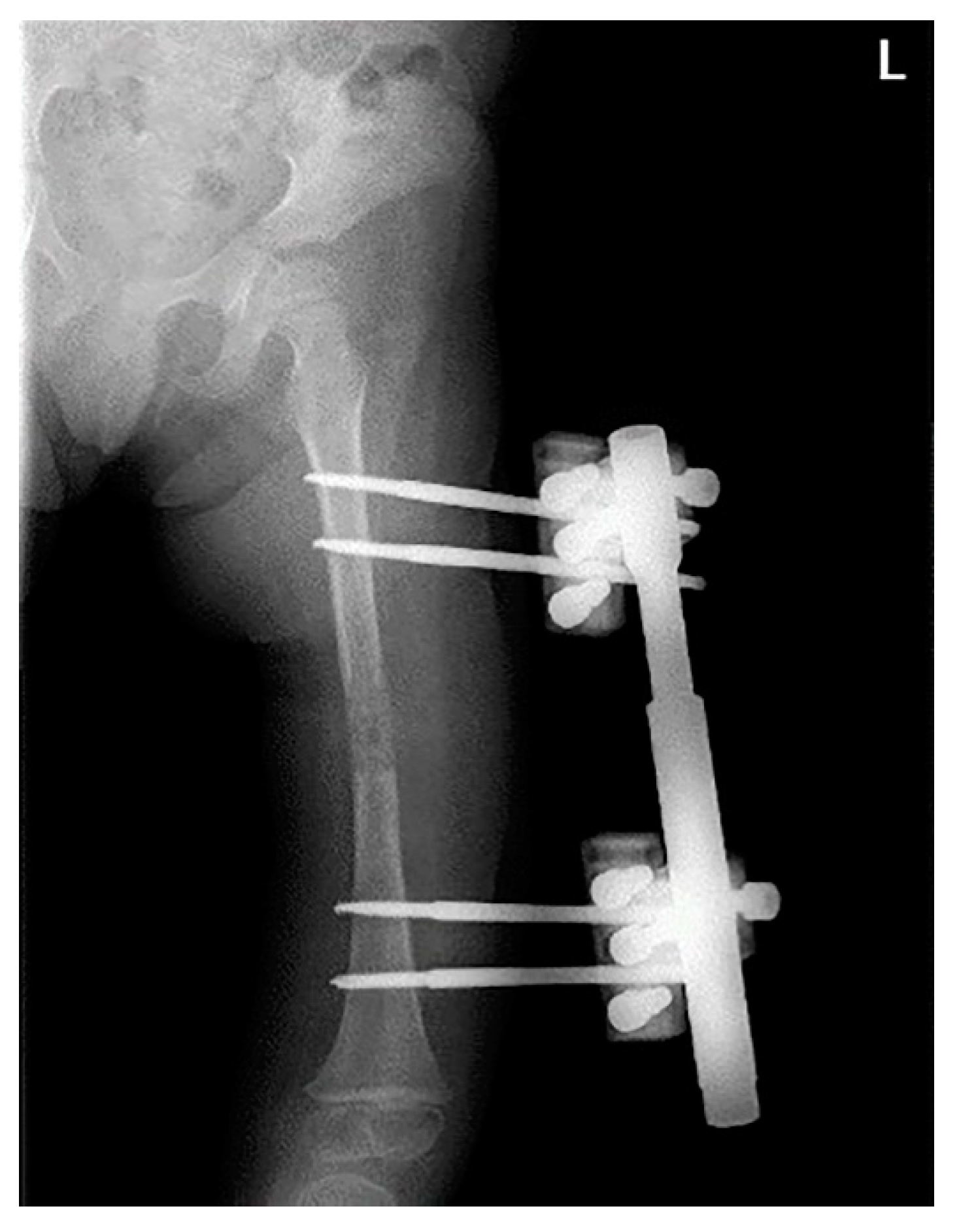 Surgeries 03 00026 g004