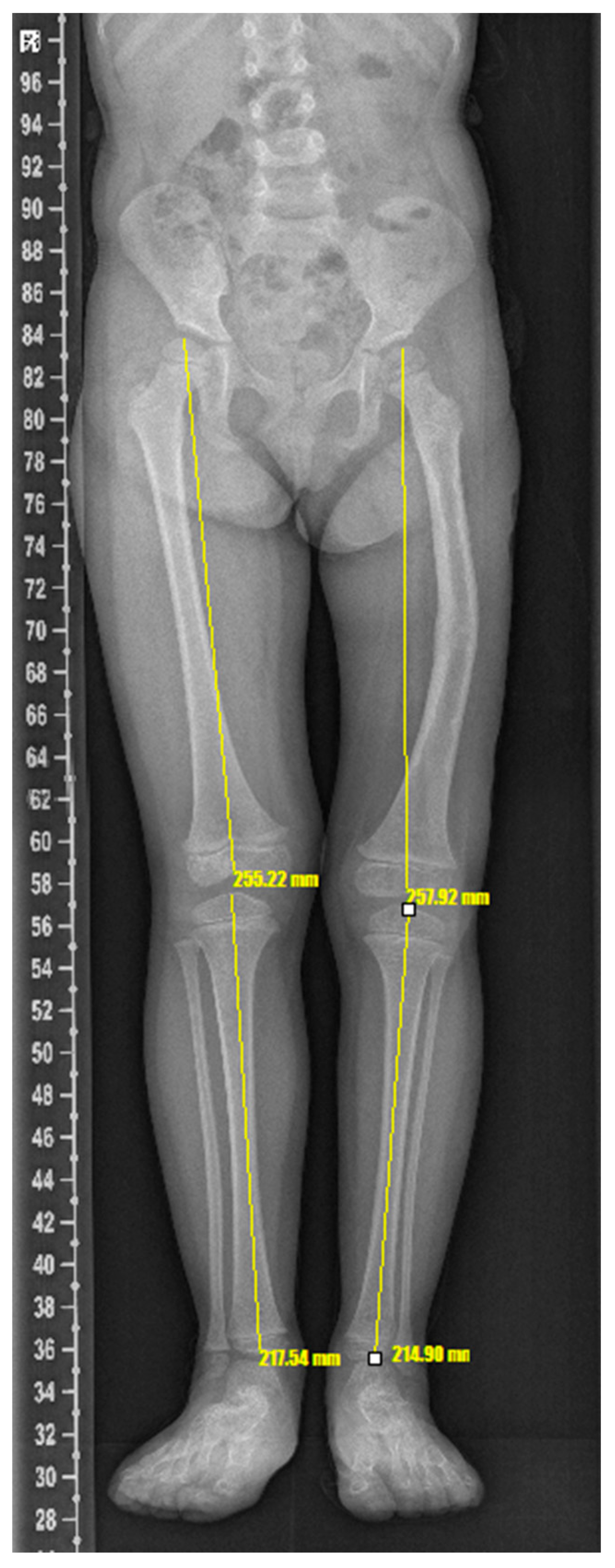 Surgeries 03 00026 g005