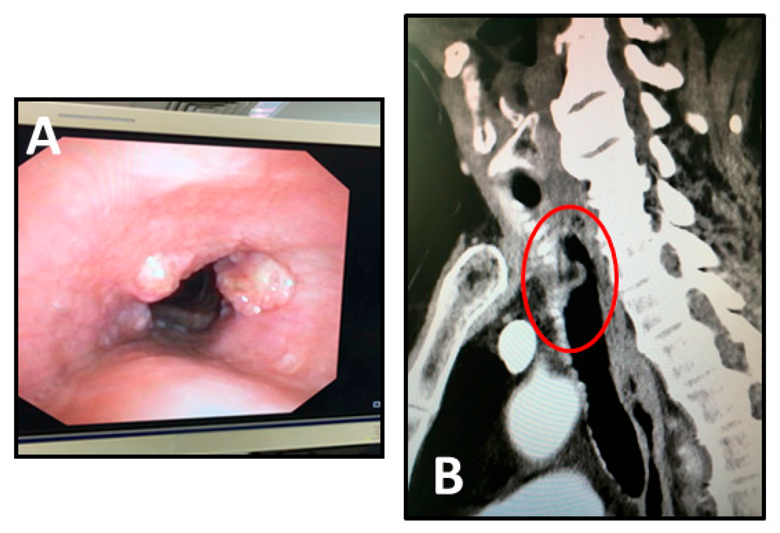 Surgeries 03 00029 g001