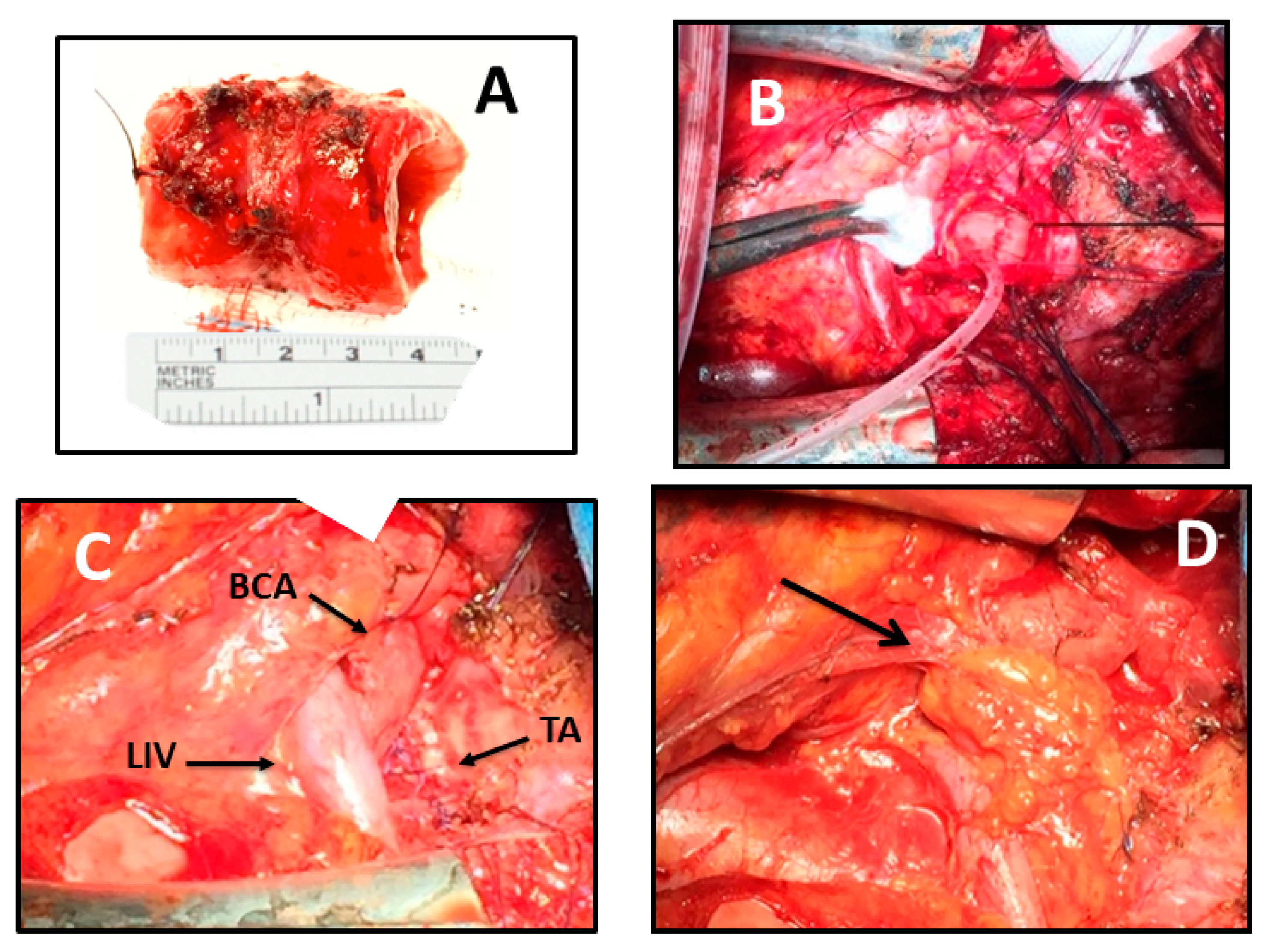 Surgeries 03 00029 g002