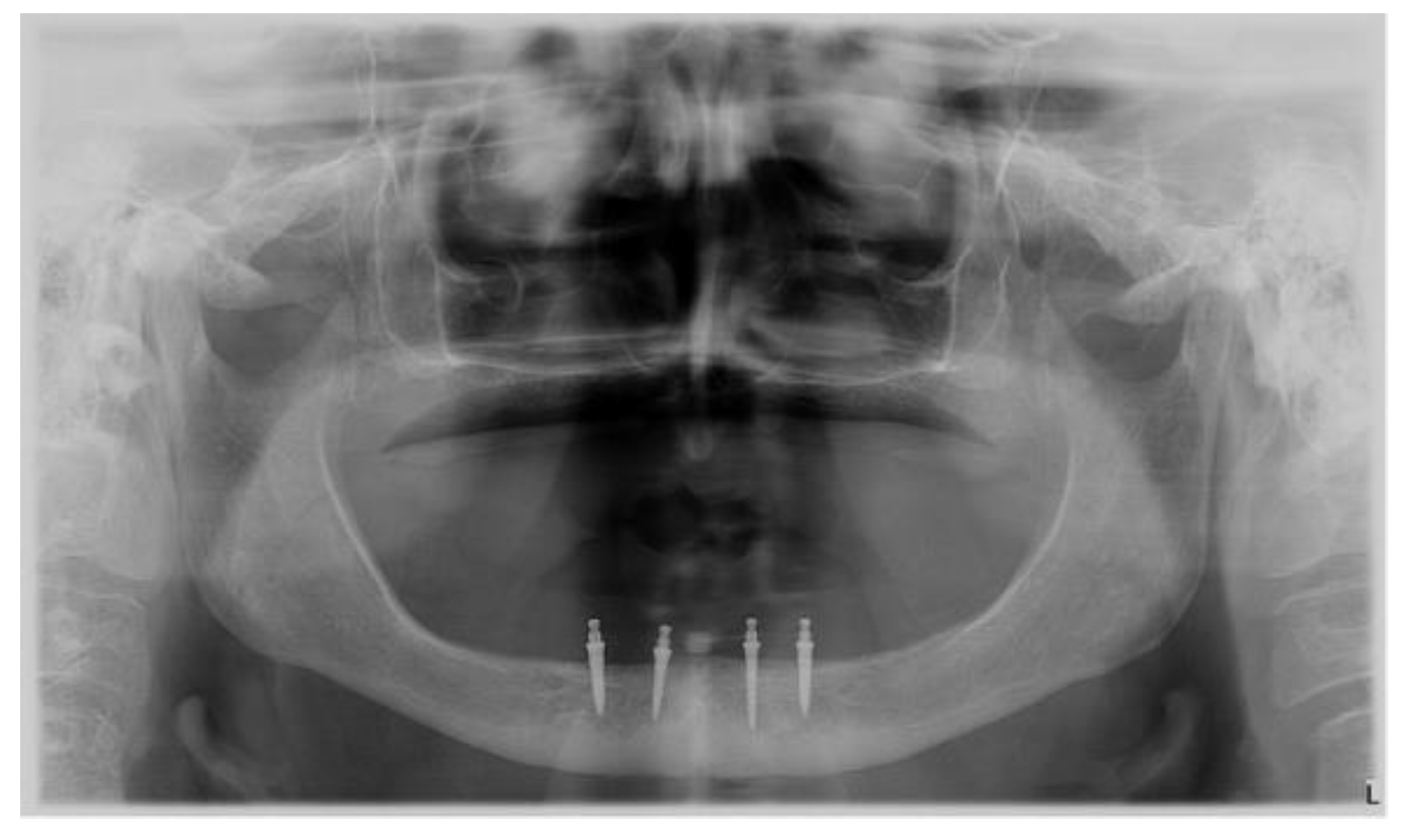 Surgeries 03 00033 g001