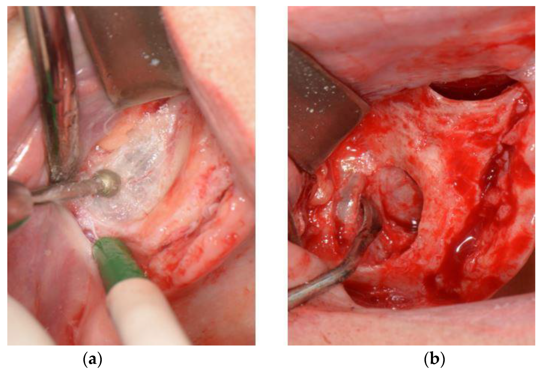Surgeries 03 00033 g002