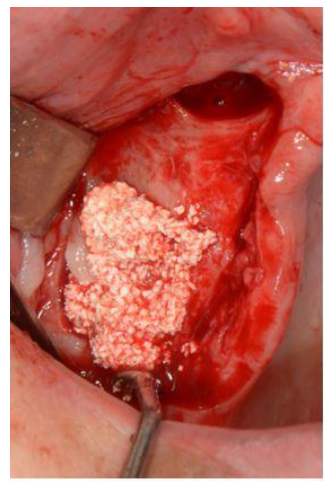 Surgeries 03 00033 g003