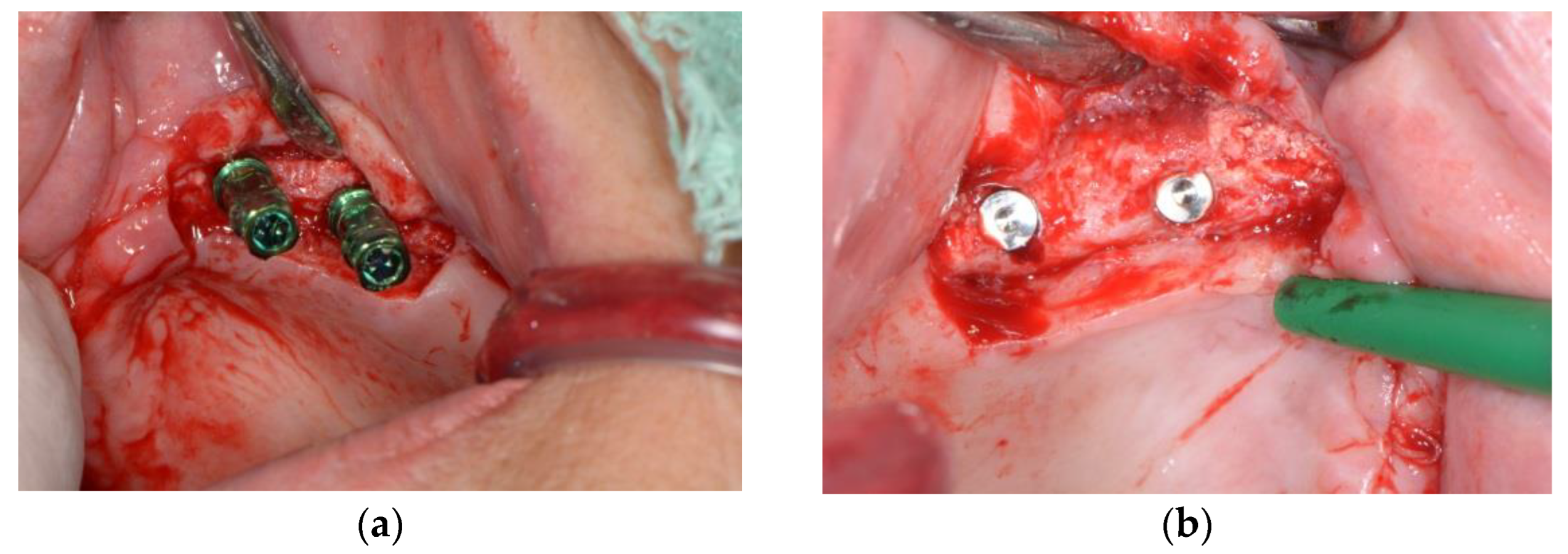 Surgeries 03 00033 g005