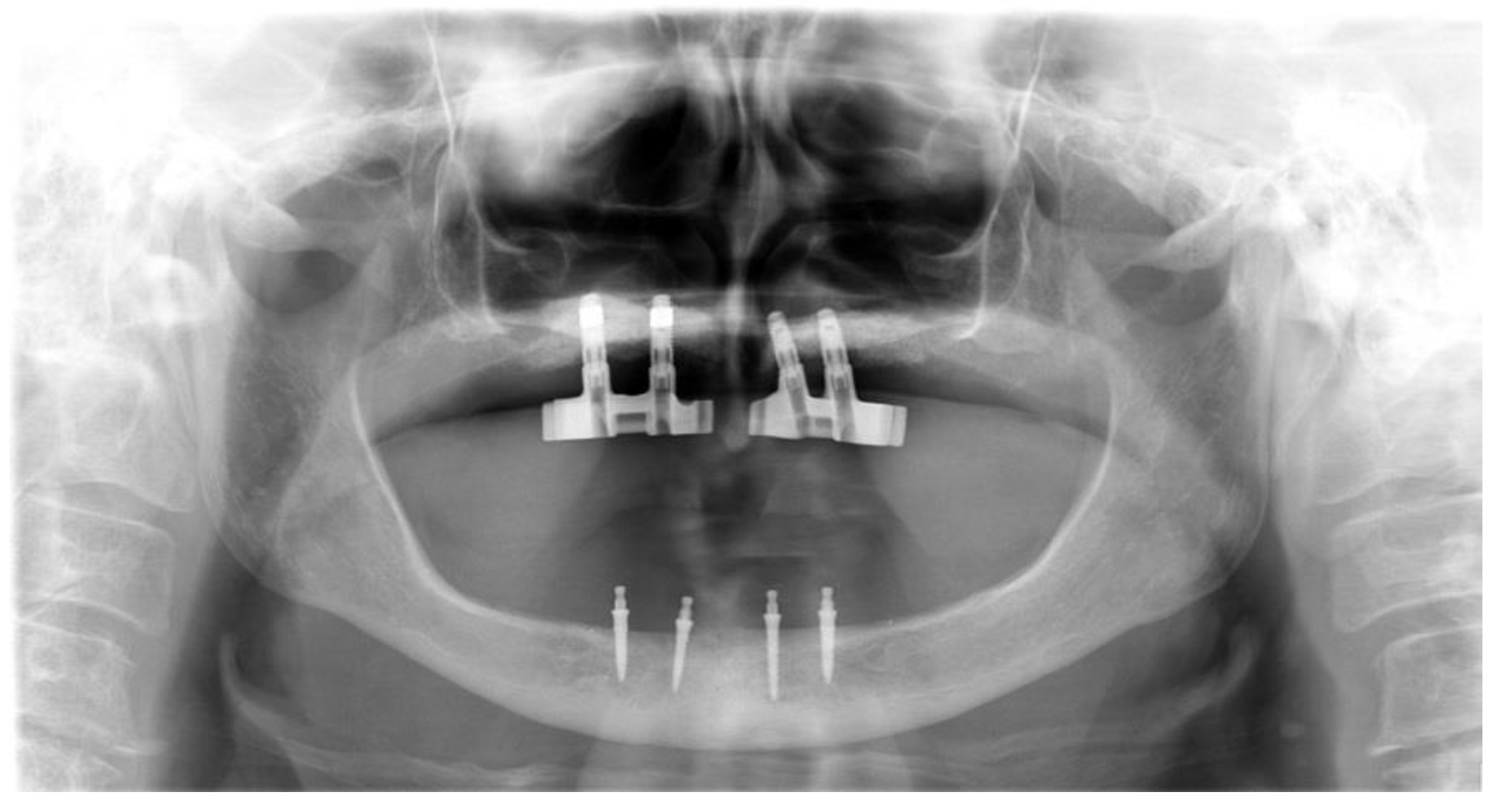 Surgeries 03 00033 g007