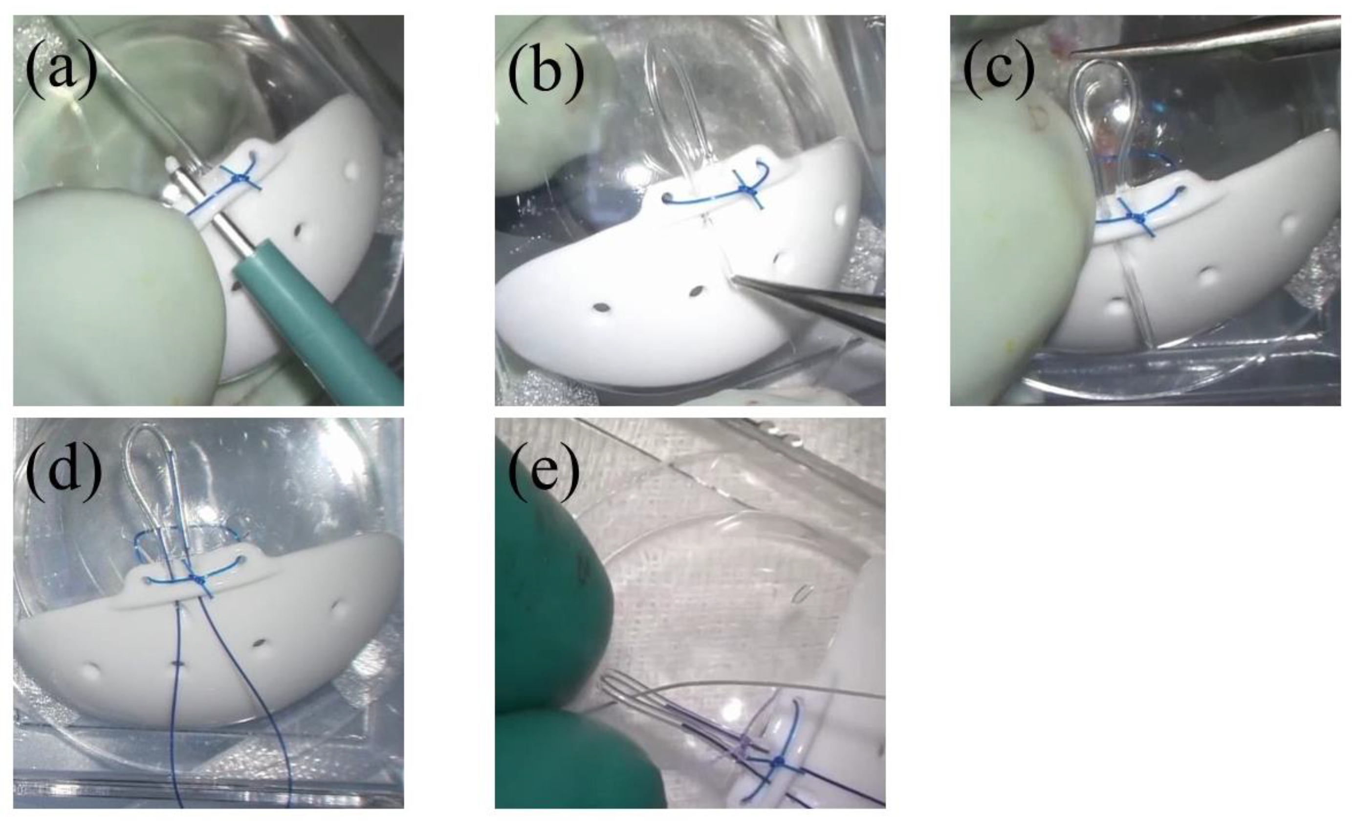 Surgeries 03 00035 g001
