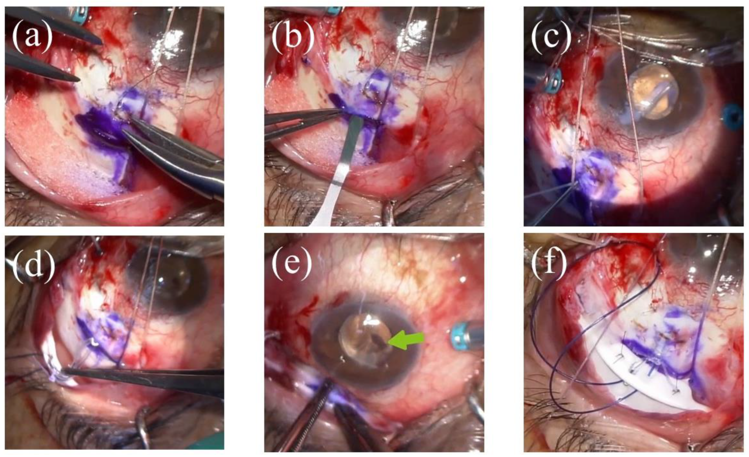 Surgeries 03 00035 g003