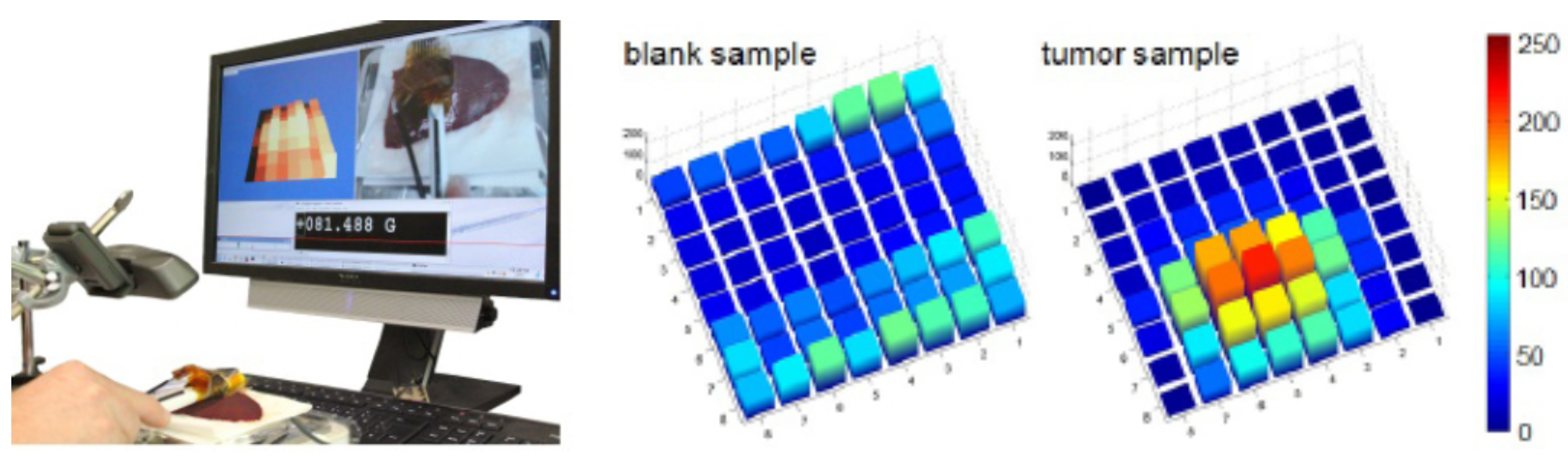Surgeries 03 00036 g006 Surgeries 03 00036 g006