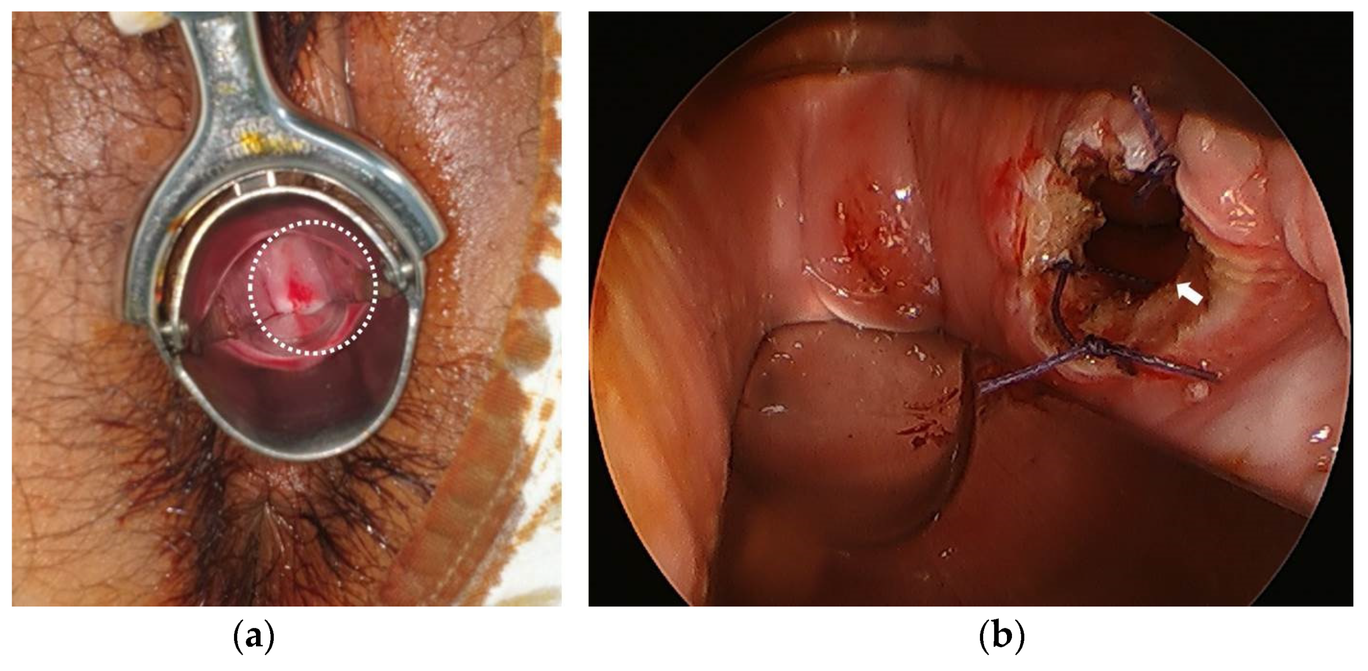 Surgeries 04 00002 g002 550