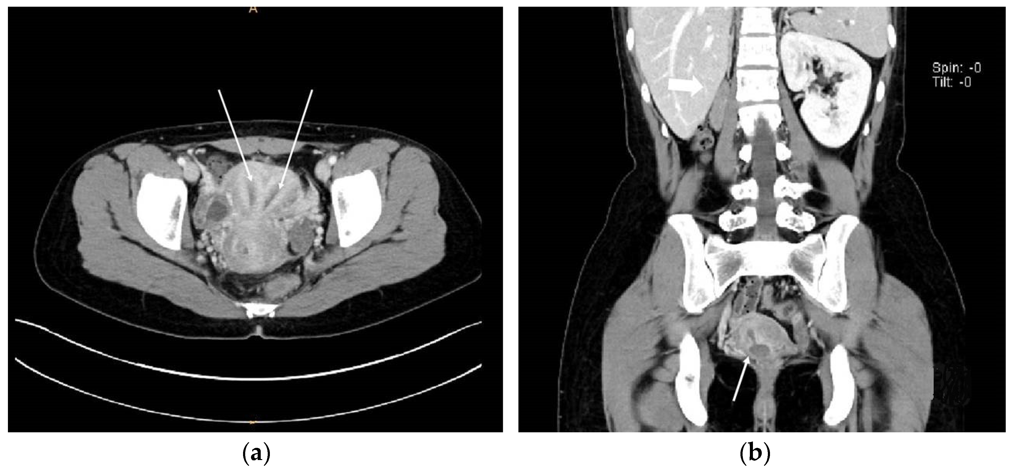 Surgeries 04 00002 g003 550