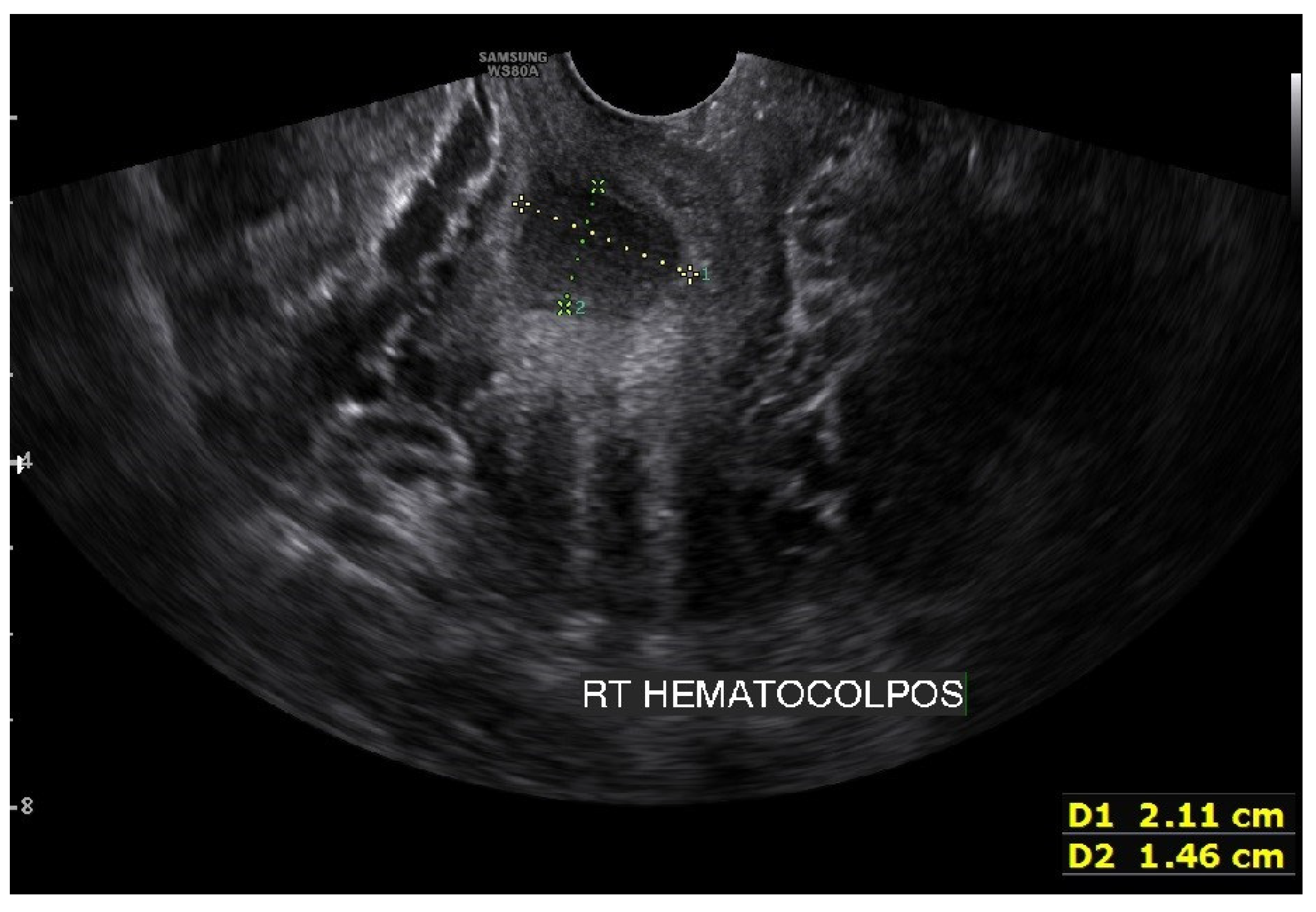 Surgeries 04 00002 g004 550