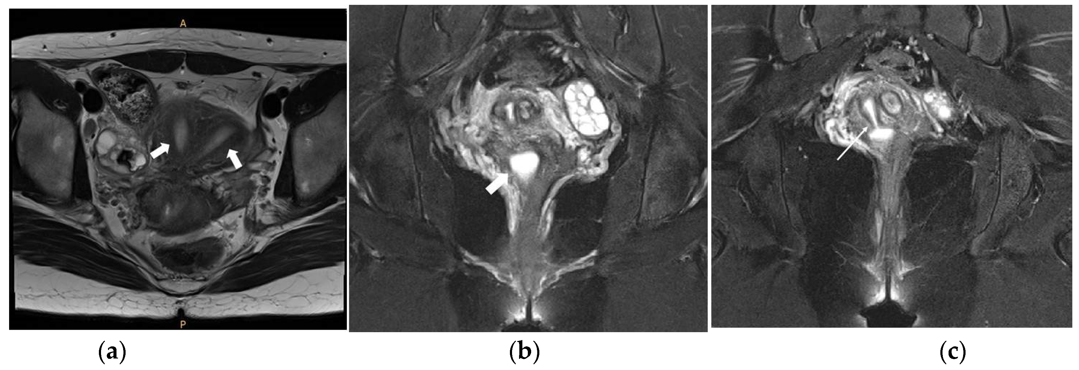 Surgeries 04 00002 g005 550