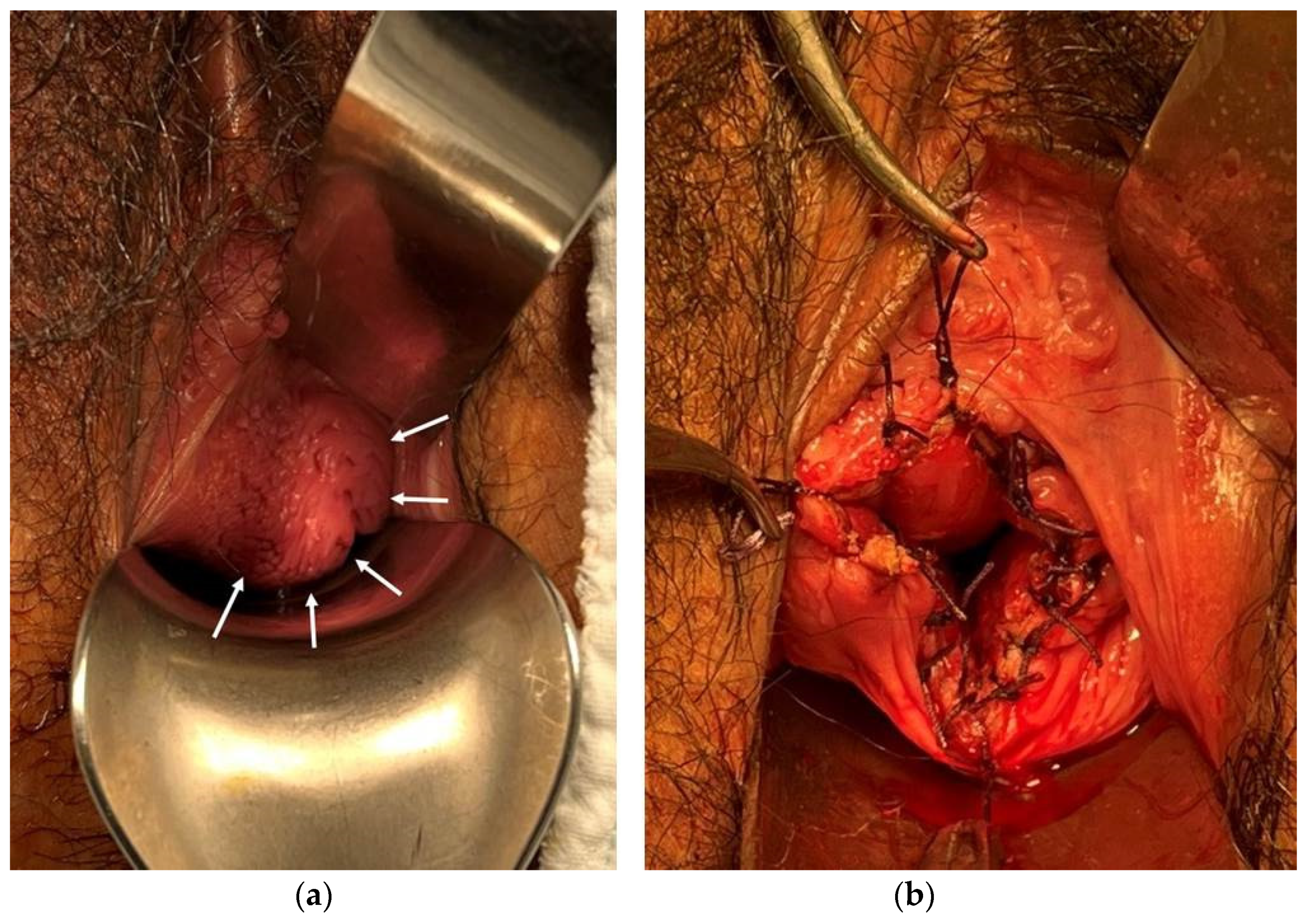 Surgeries 04 00002 g007 550