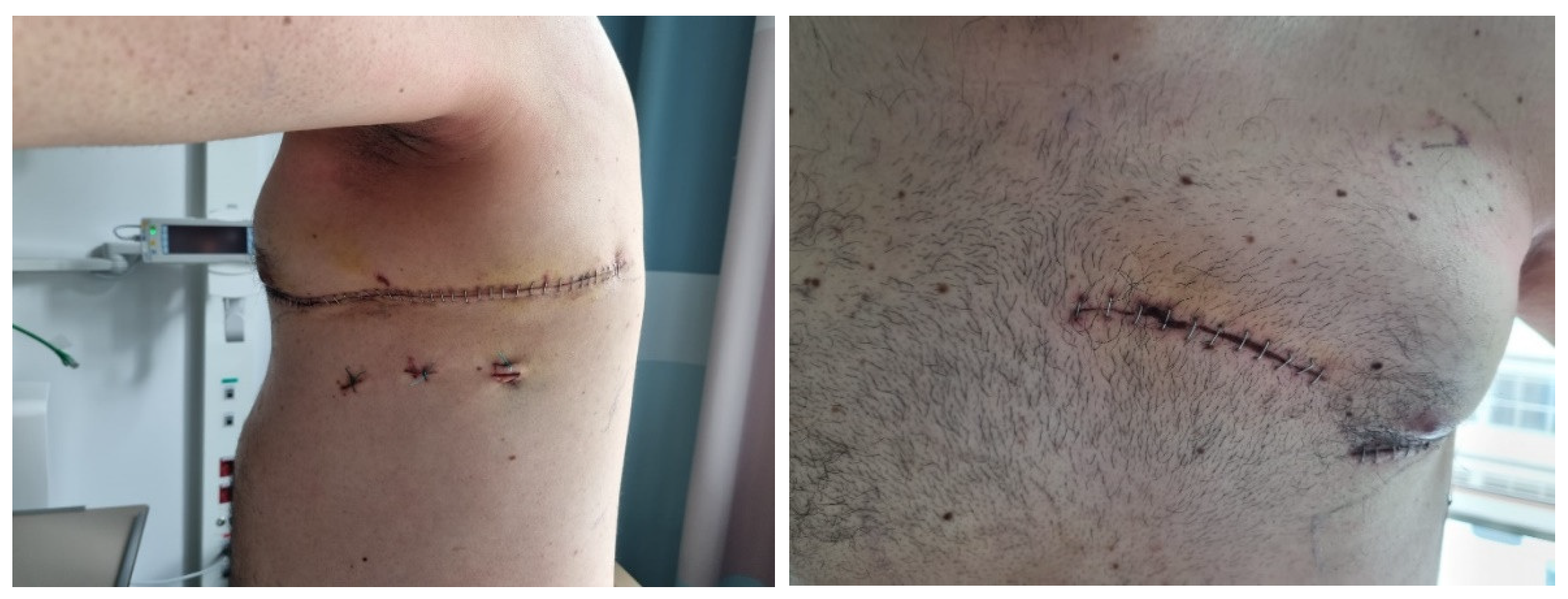 Surgeries 04 00006 g004