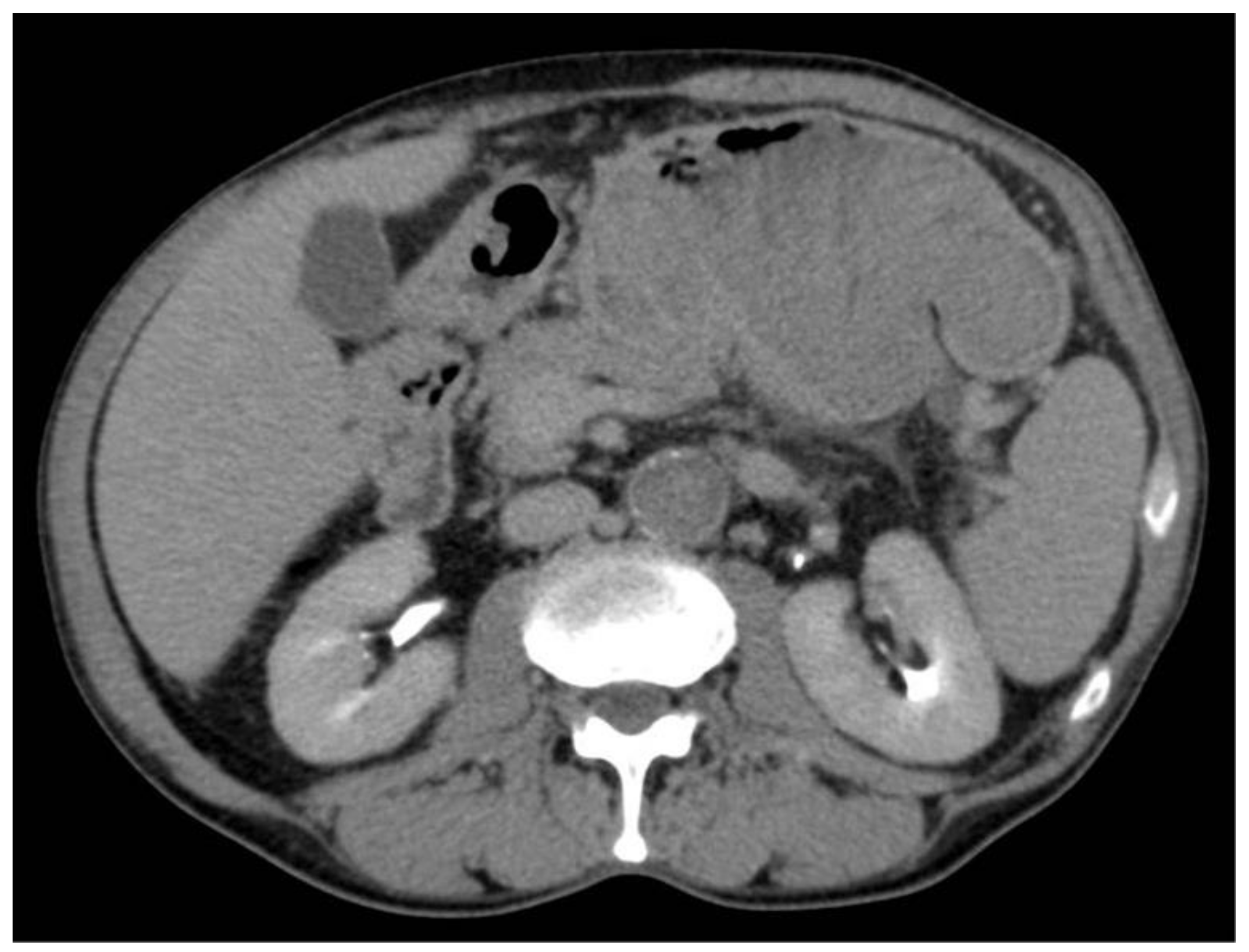 Surgeries 04 00009 g003 550