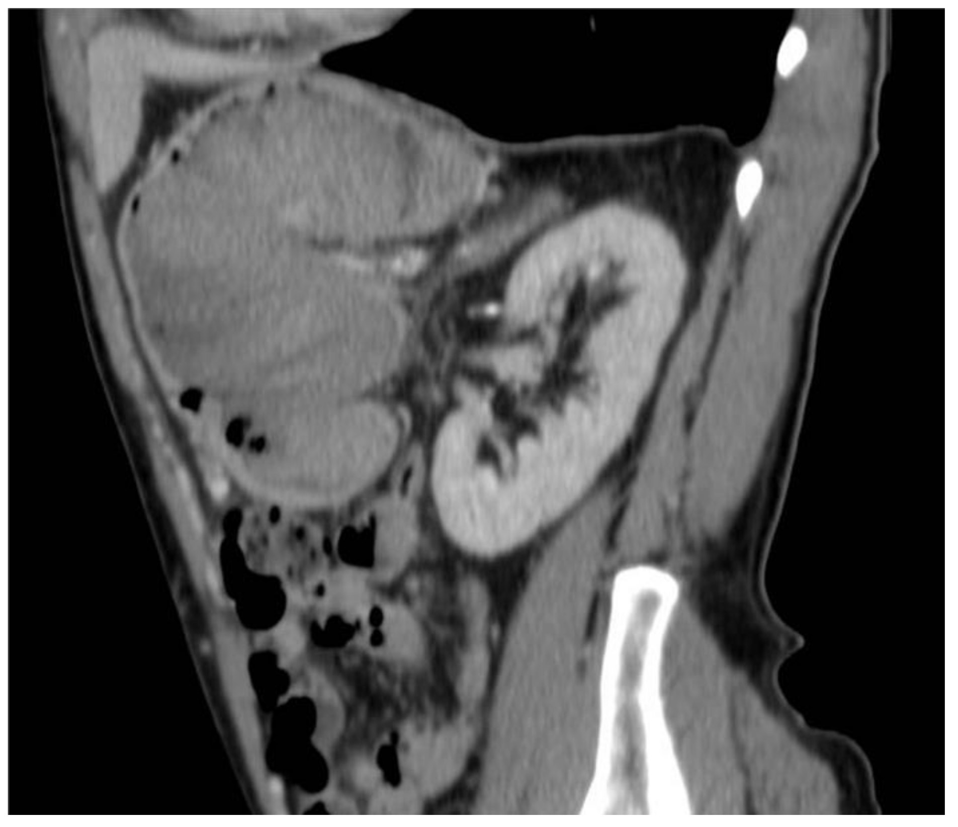 Surgeries 04 00009 g005 550