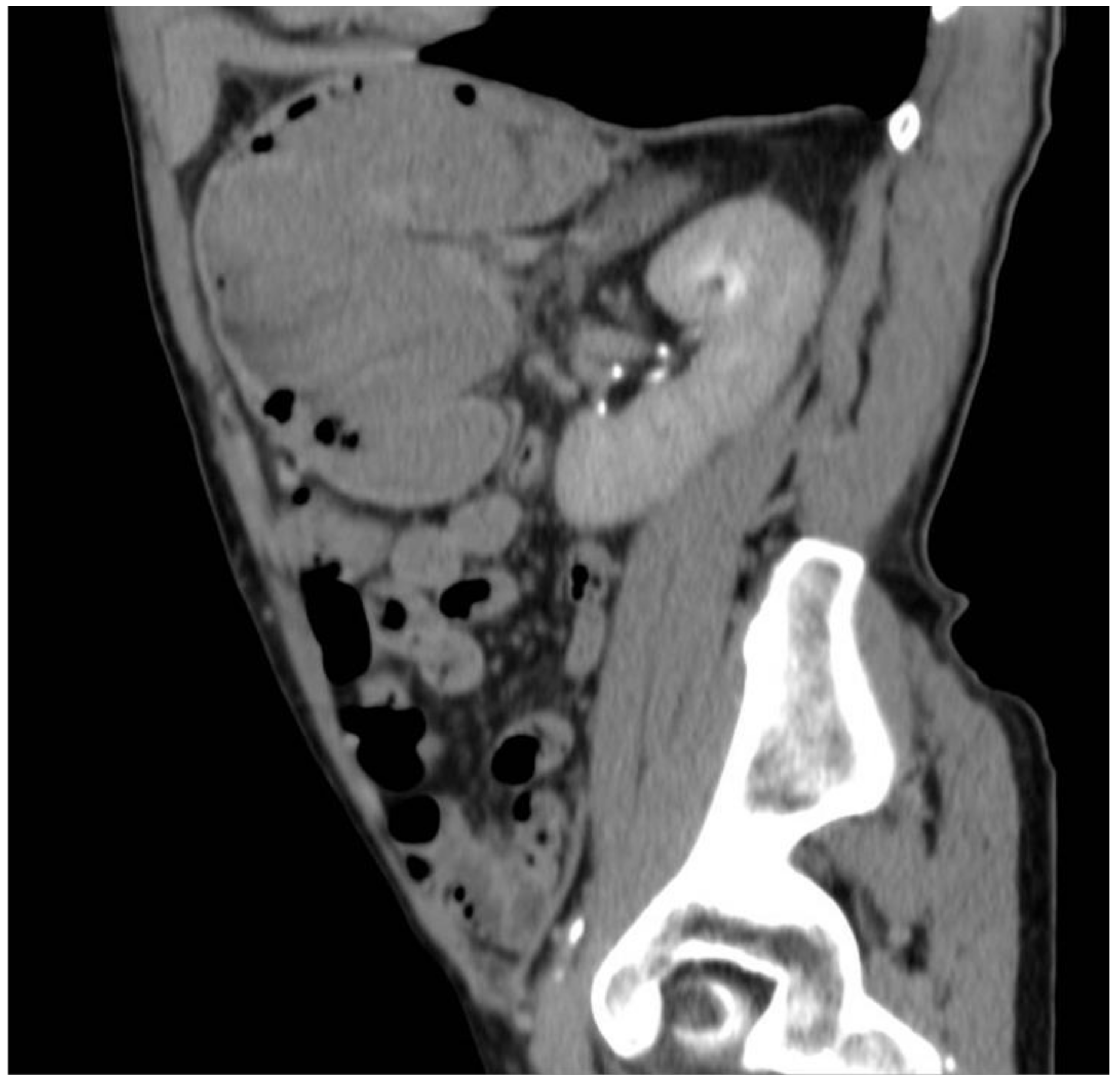 Surgeries 04 00009 g006 550