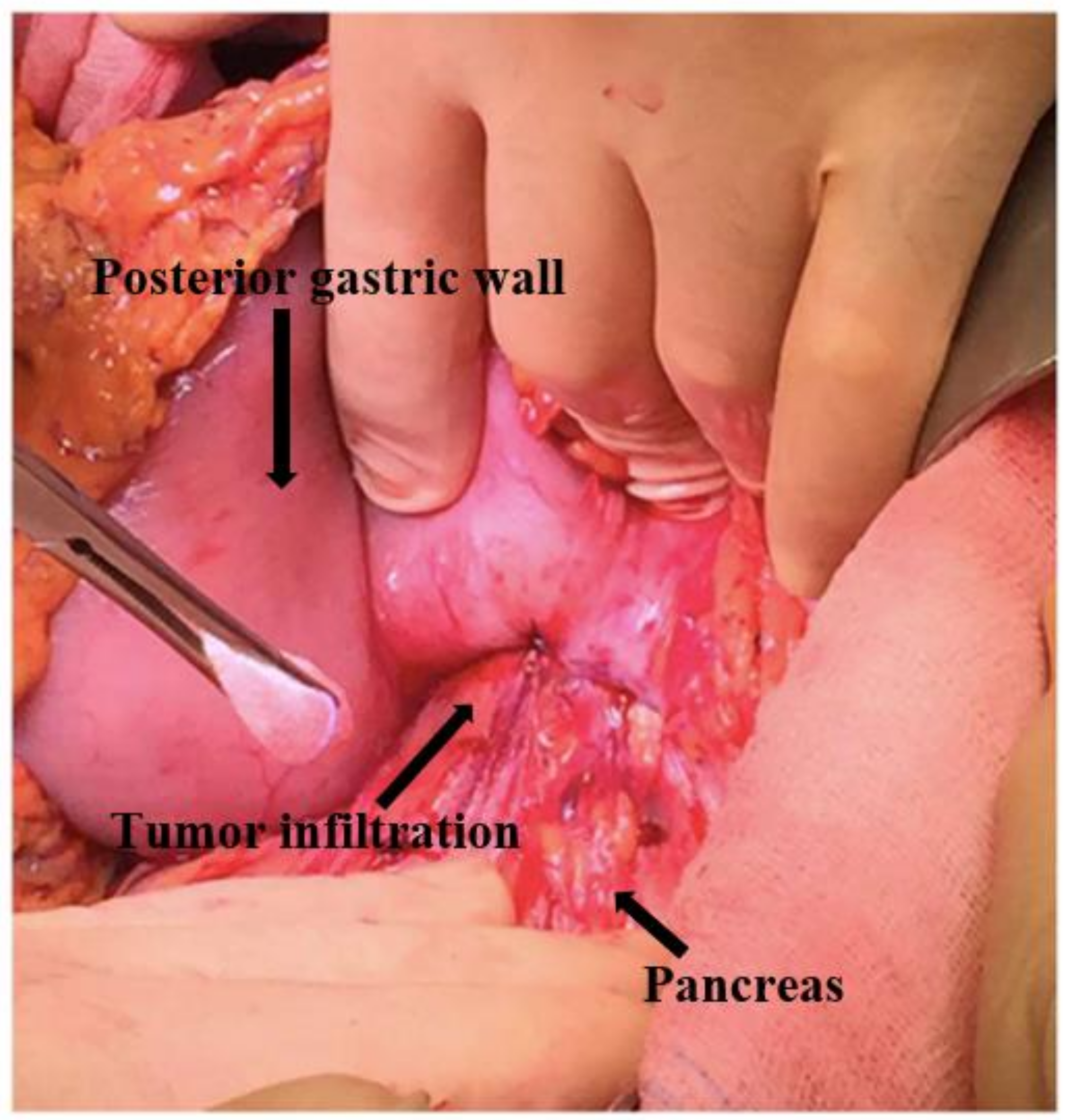 Surgeries 04 00009 g007 550