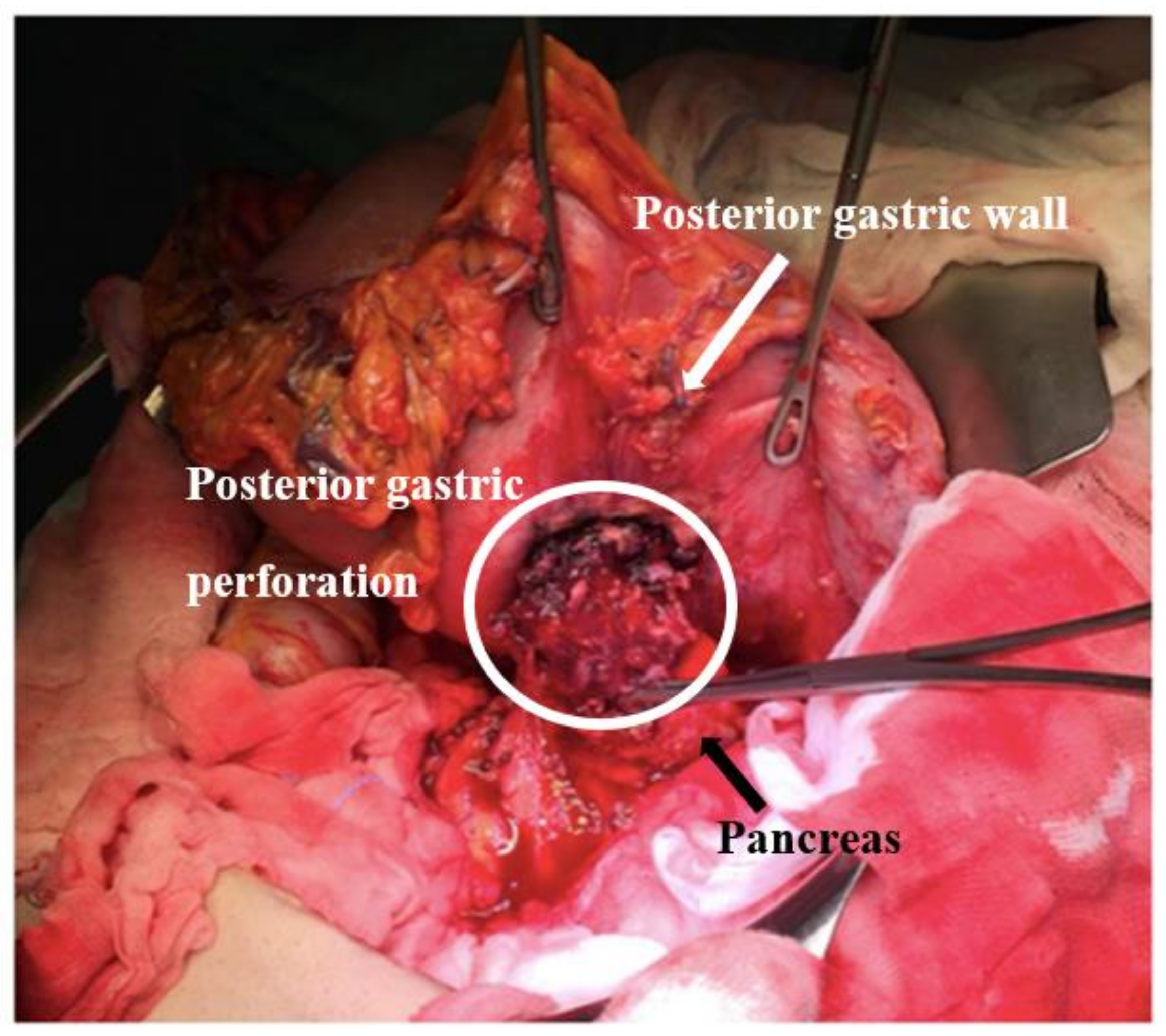 Surgeries 04 00009 g008 550
