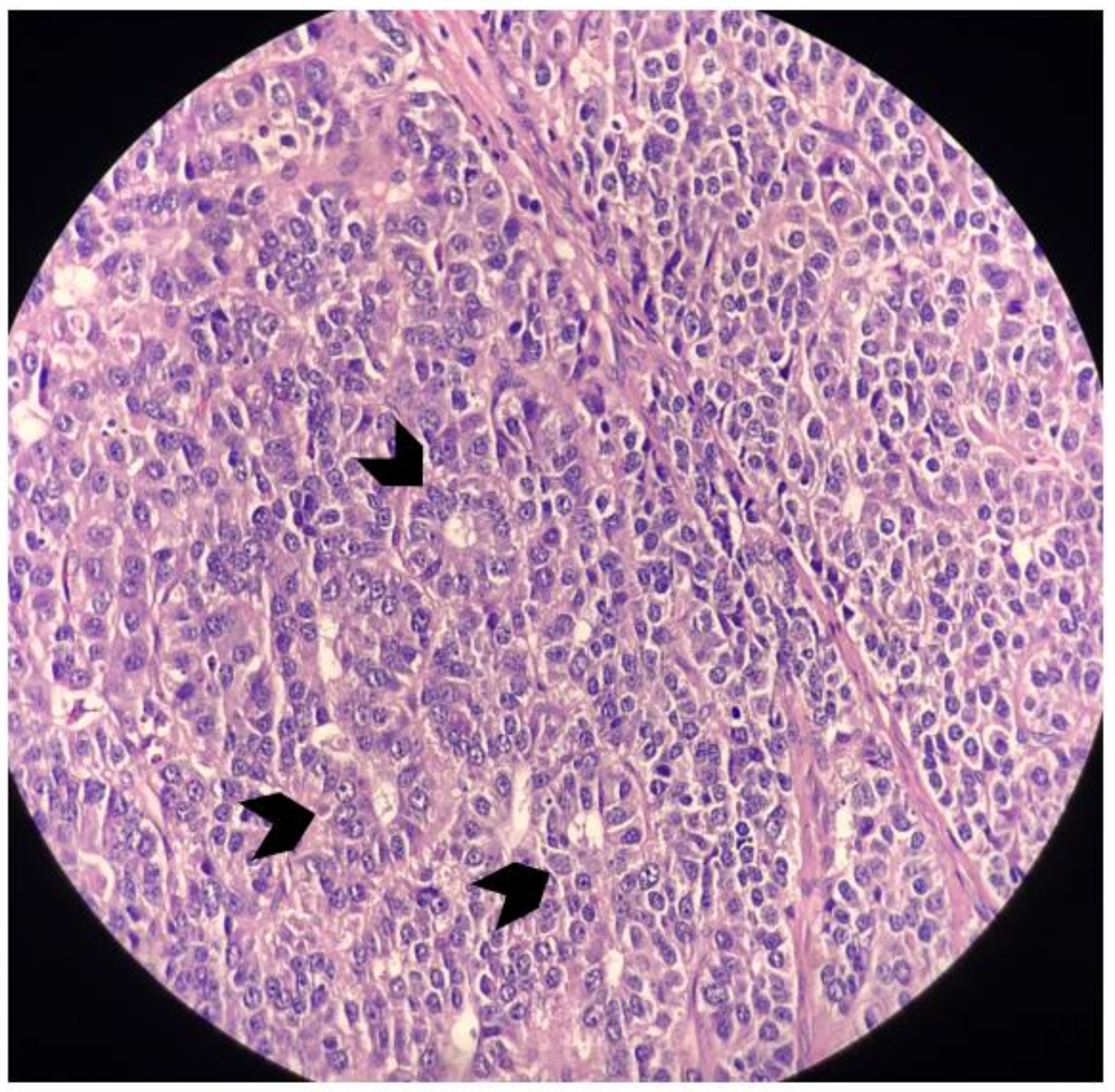 Surgeries 04 00009 g010 550