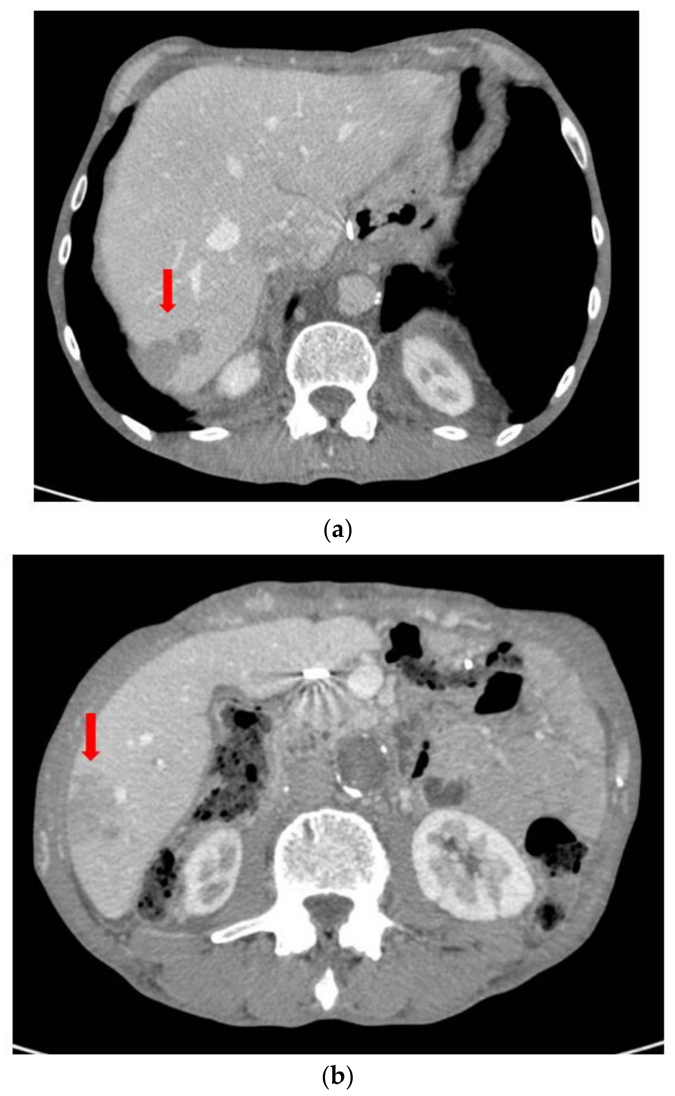 Surgeries 04 00009 g011 550