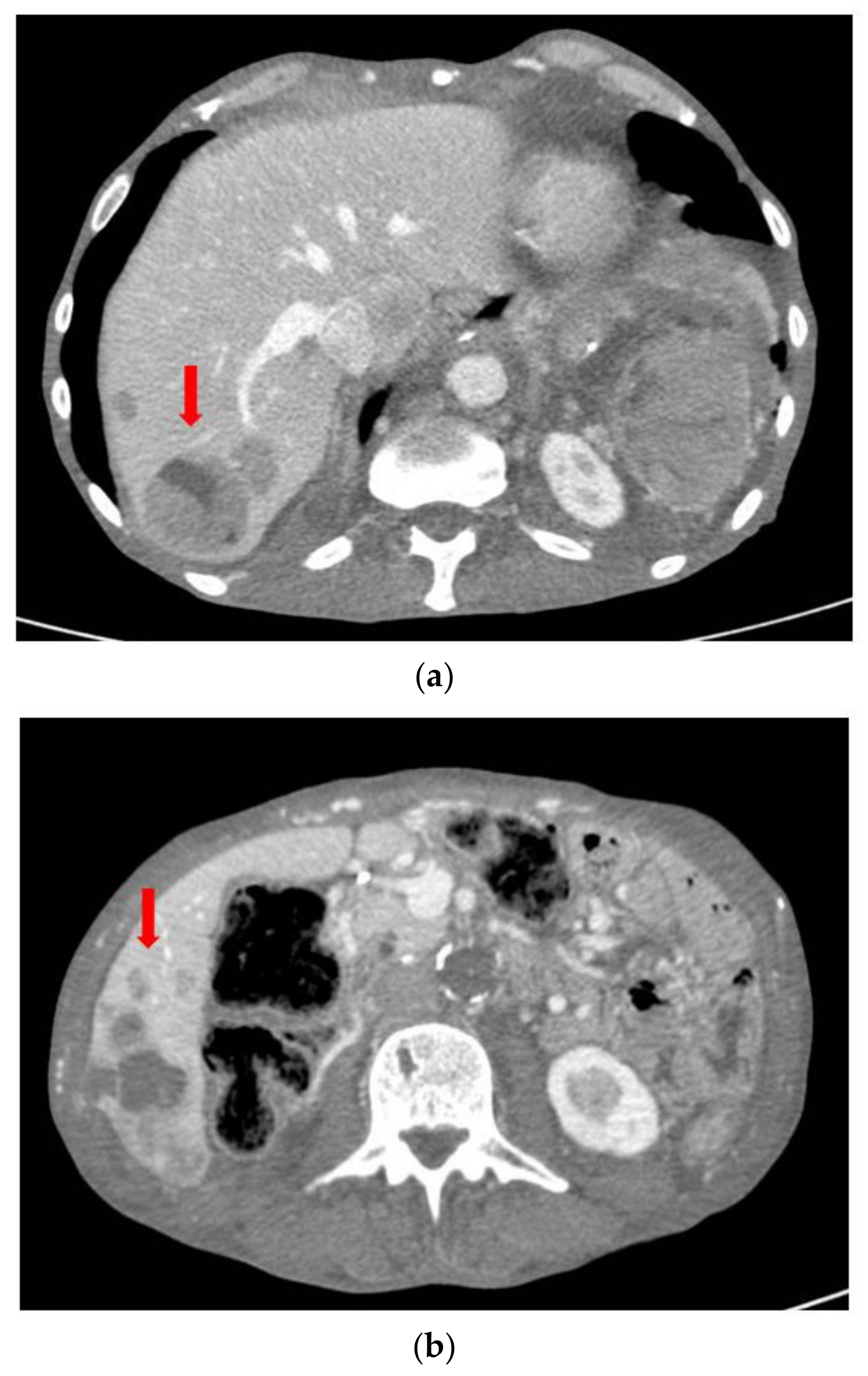 Surgeries 04 00009 g012 550