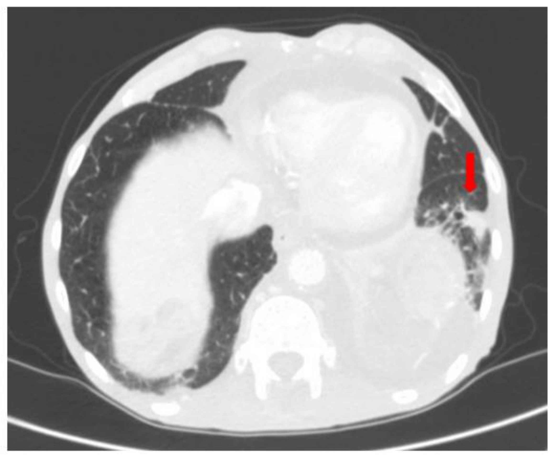 Surgeries 04 00009 g013 550