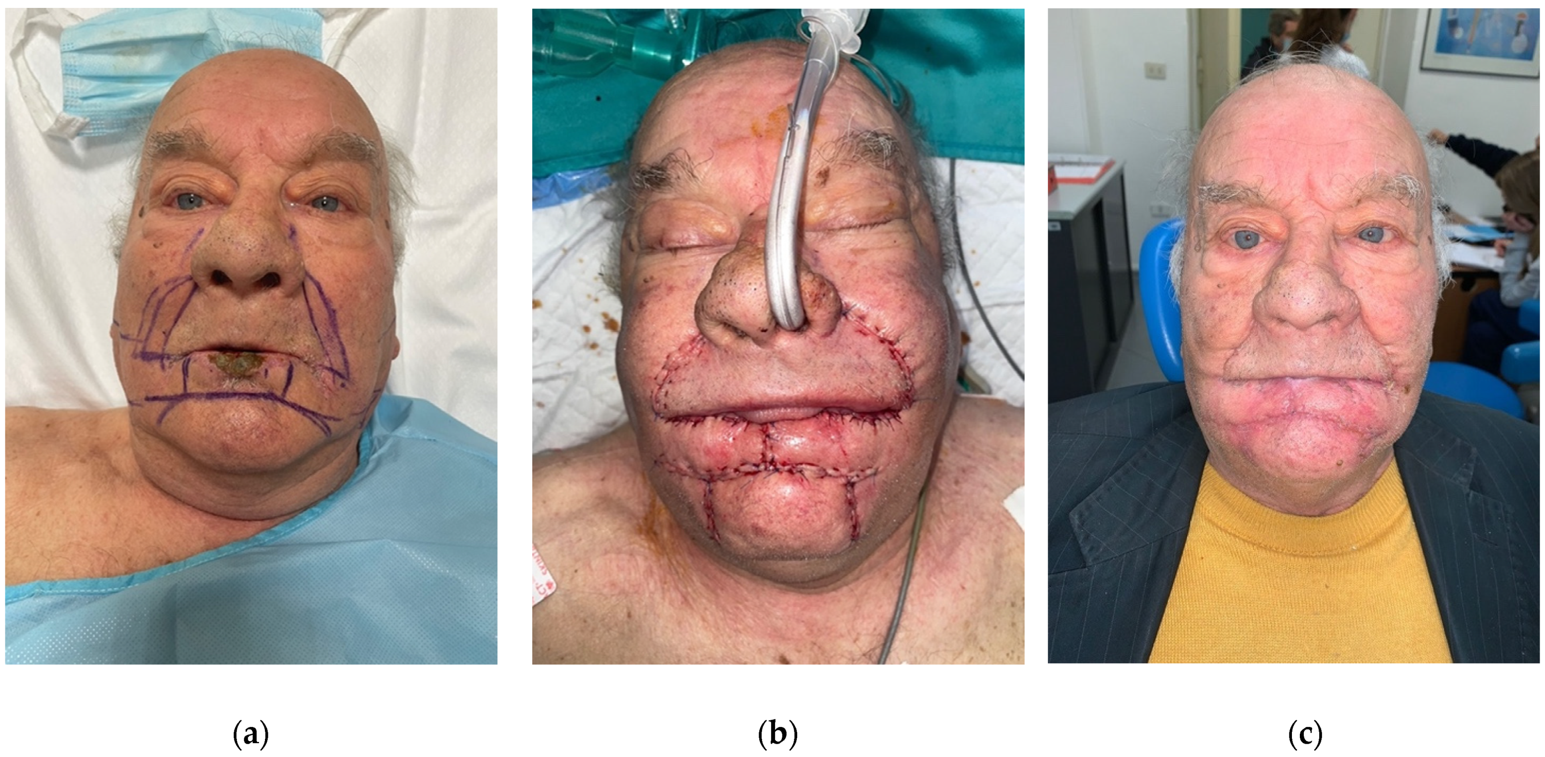Surgeries 04 00012 g002 Surgeries 04 00012 g002