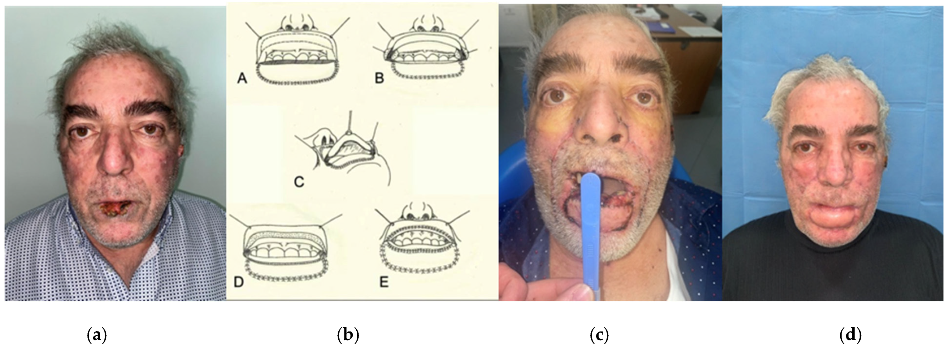 Surgeries 04 00012 g003 Surgeries 04 00012 g003