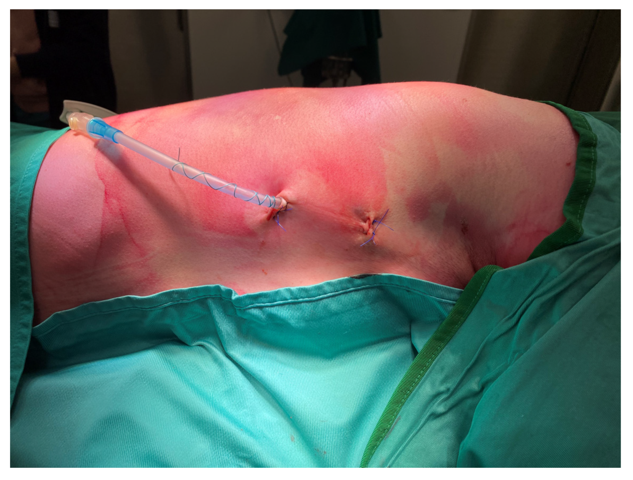 Surgeries 04 00014 g001