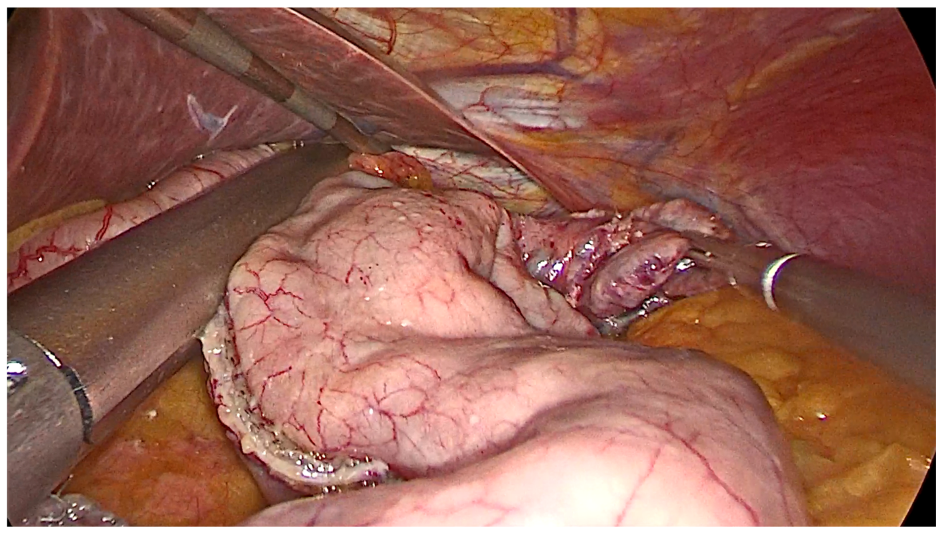 Surgeries 04 00015 g003 Surgeries 04 00015 g003