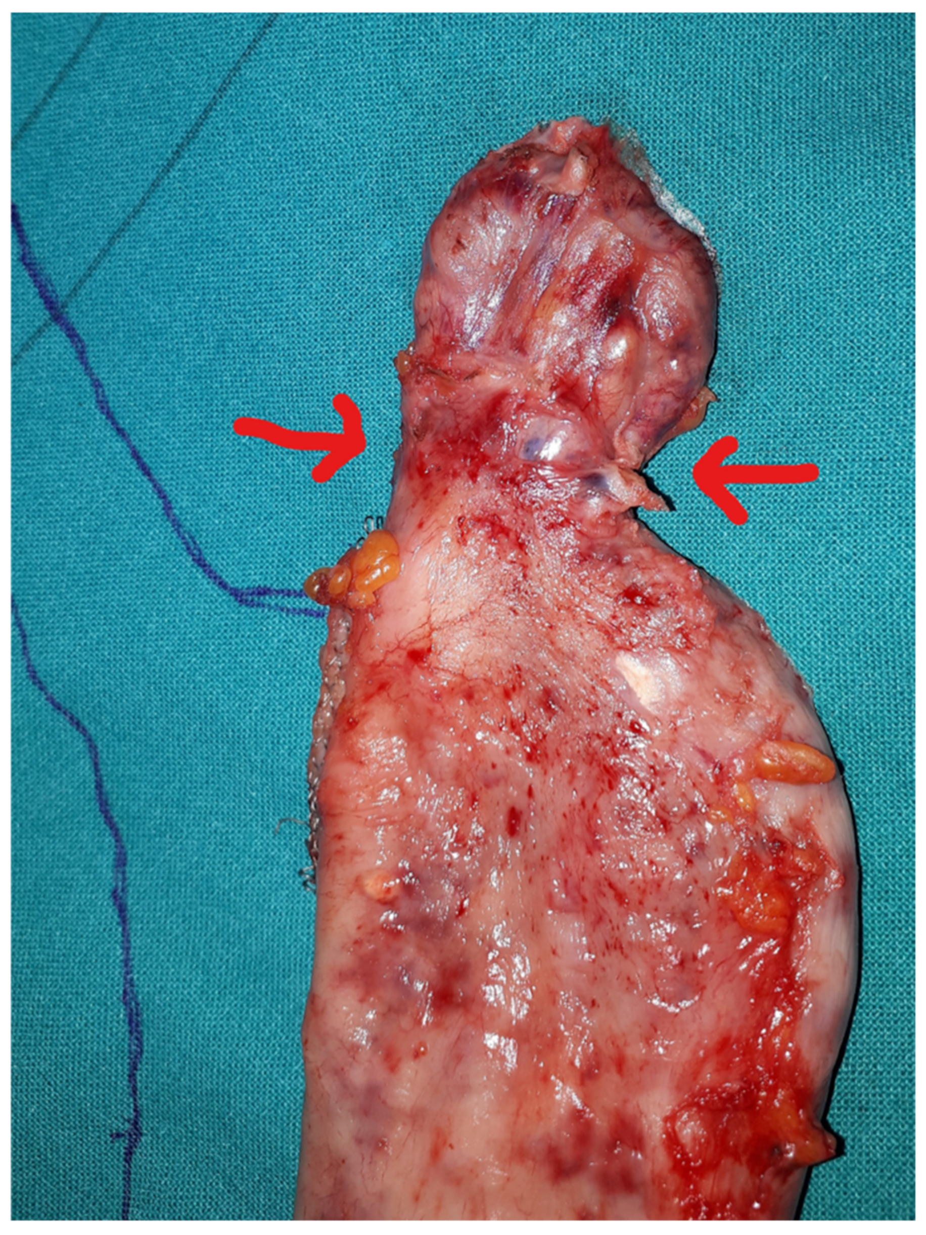 Surgeries 04 00015 g004 Surgeries 04 00015 g004