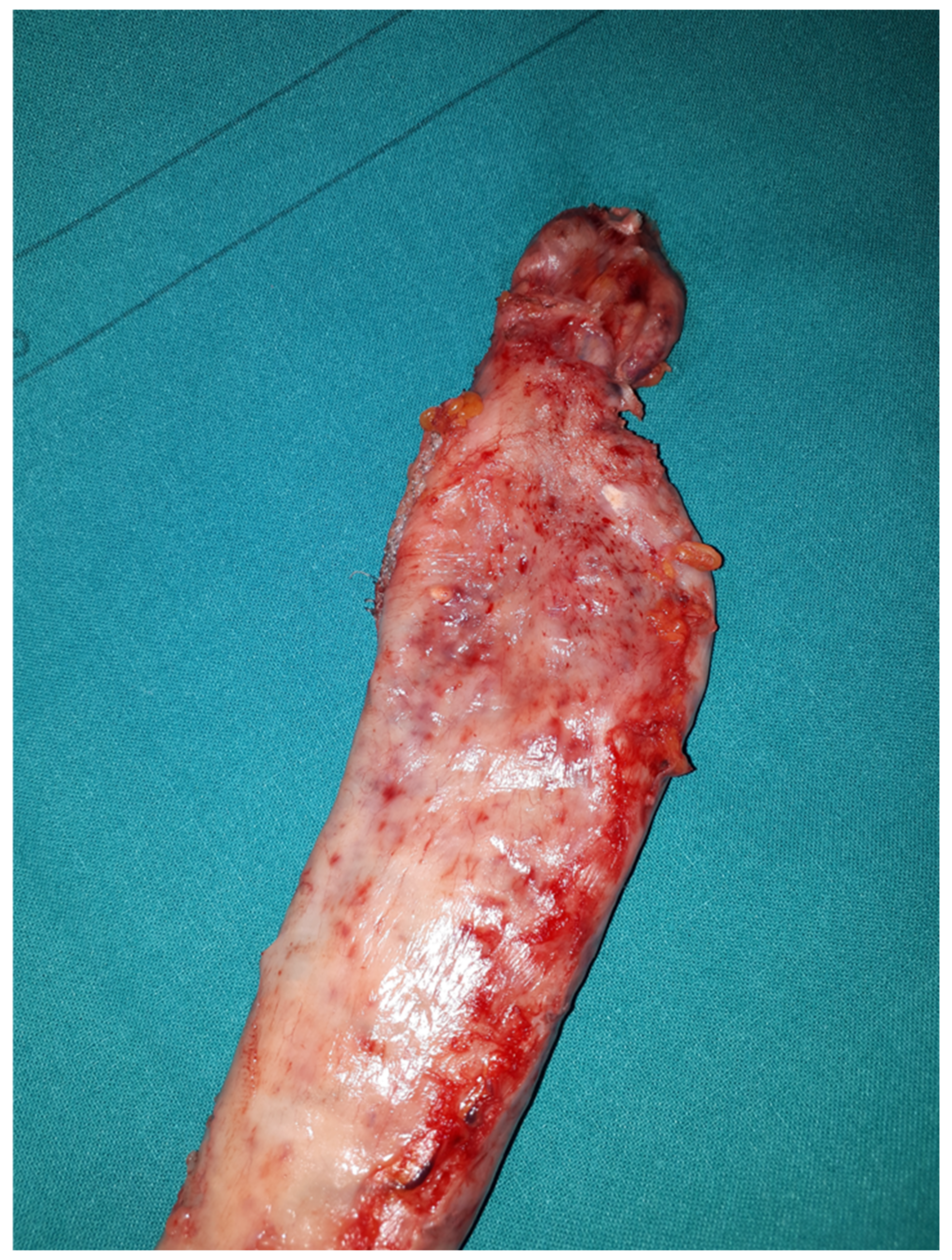 Surgeries 04 00015 g005 Surgeries 04 00015 g005