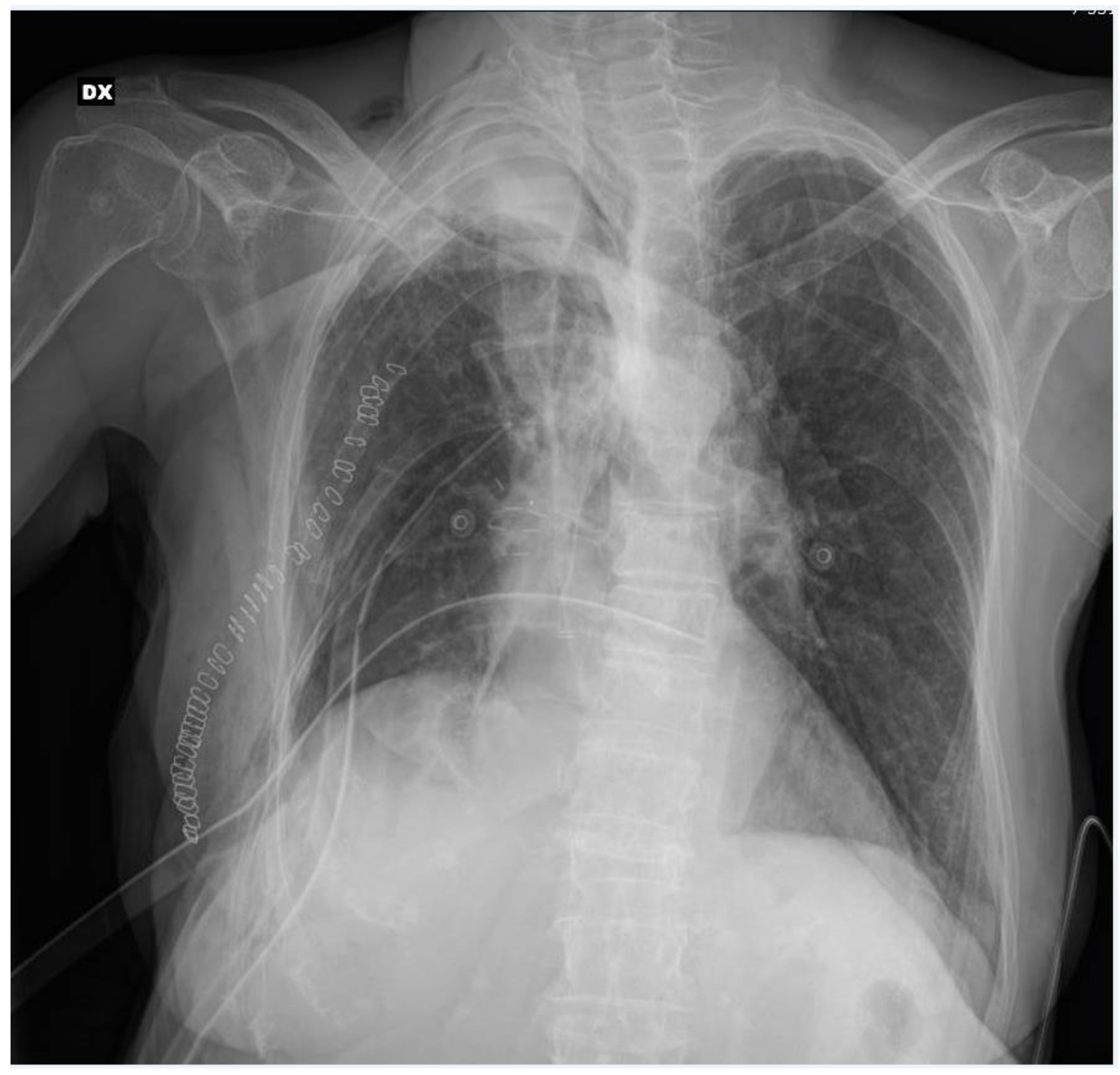 Surgeries 04 00018 g002 Surgeries 04 00018 g002