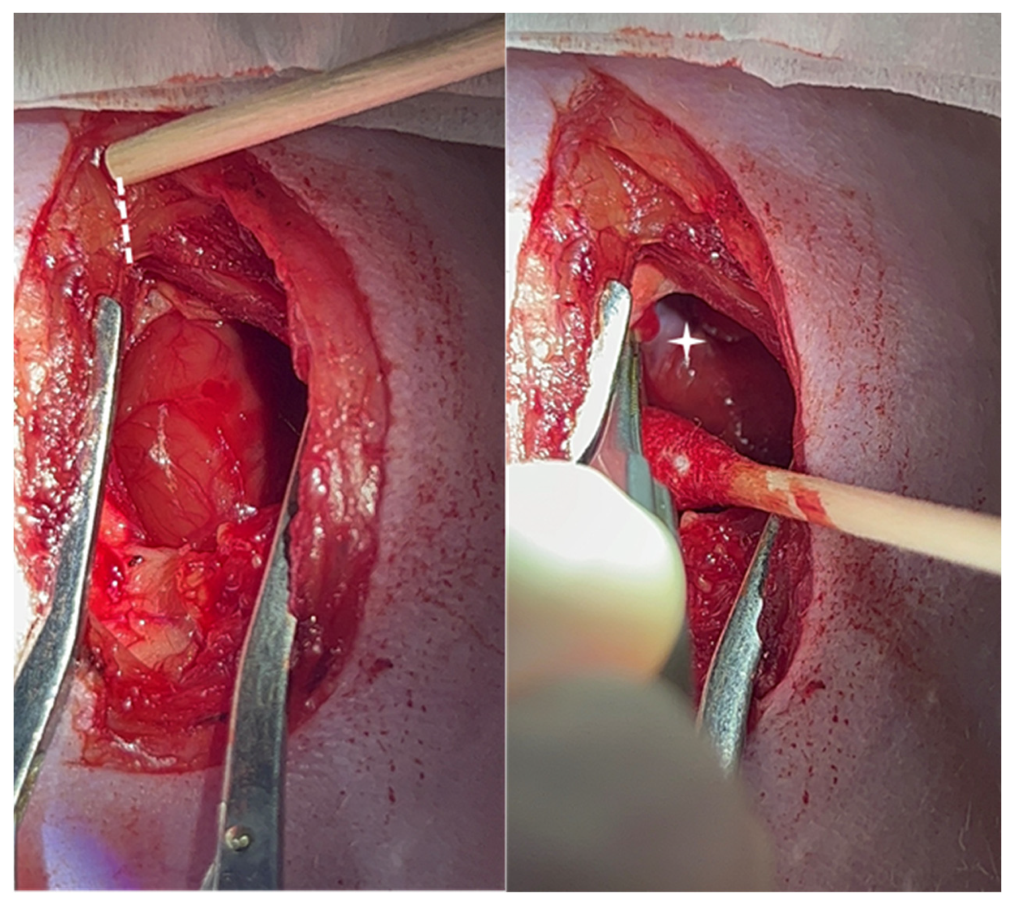 Surgeries 04 00020 g001