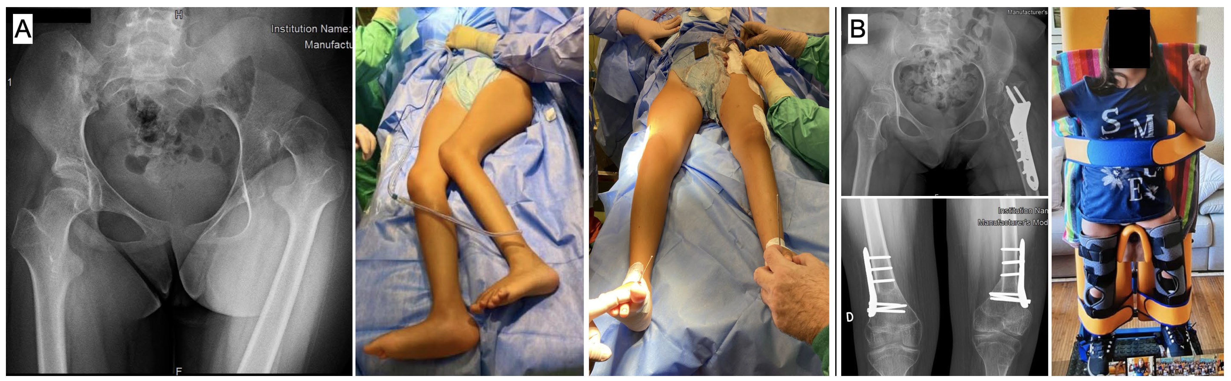 Surgeries 04 00022 g005 Surgeries 04 00022 g005