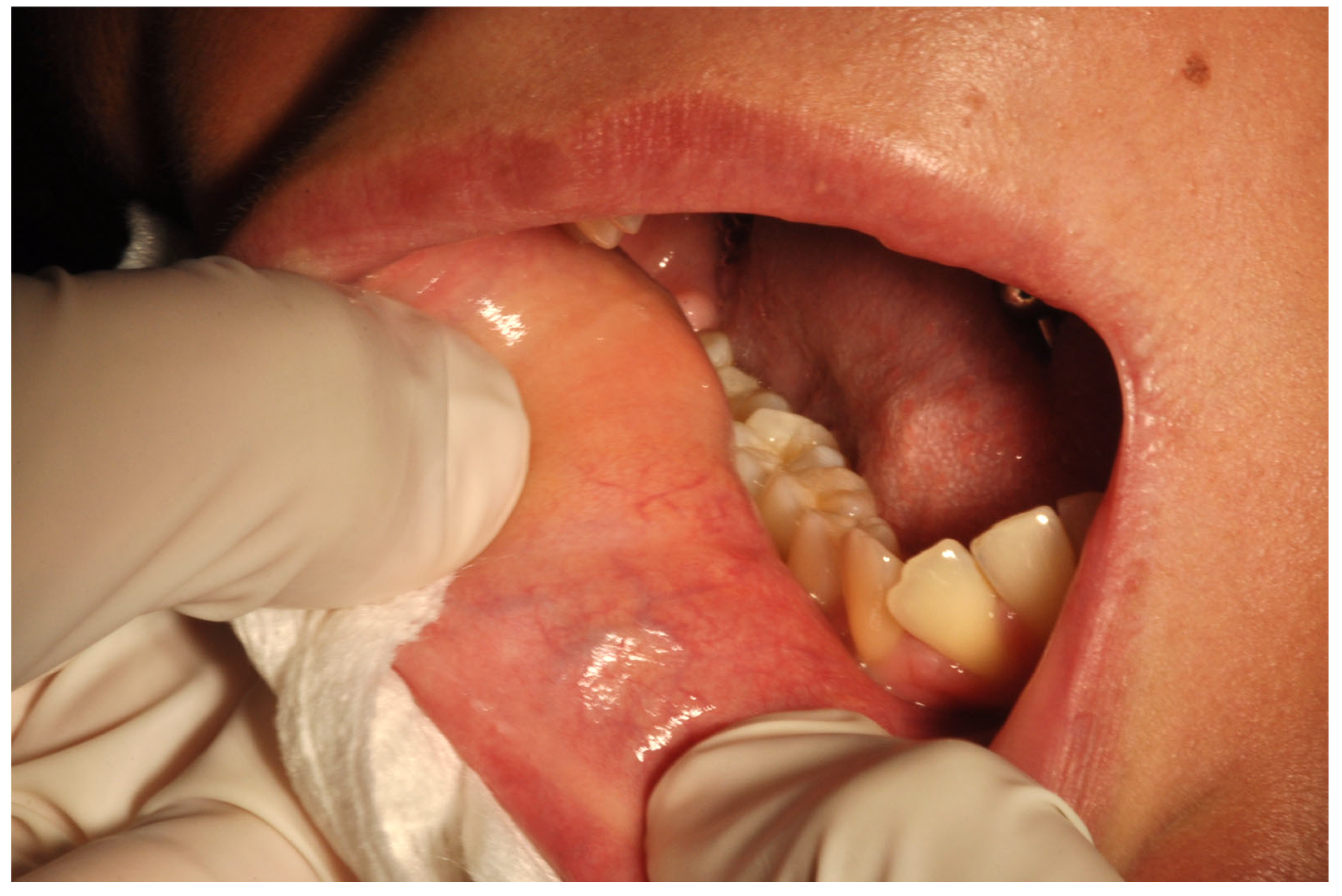 Surgeries 04 00023 g001 Surgeries 04 00023 g001