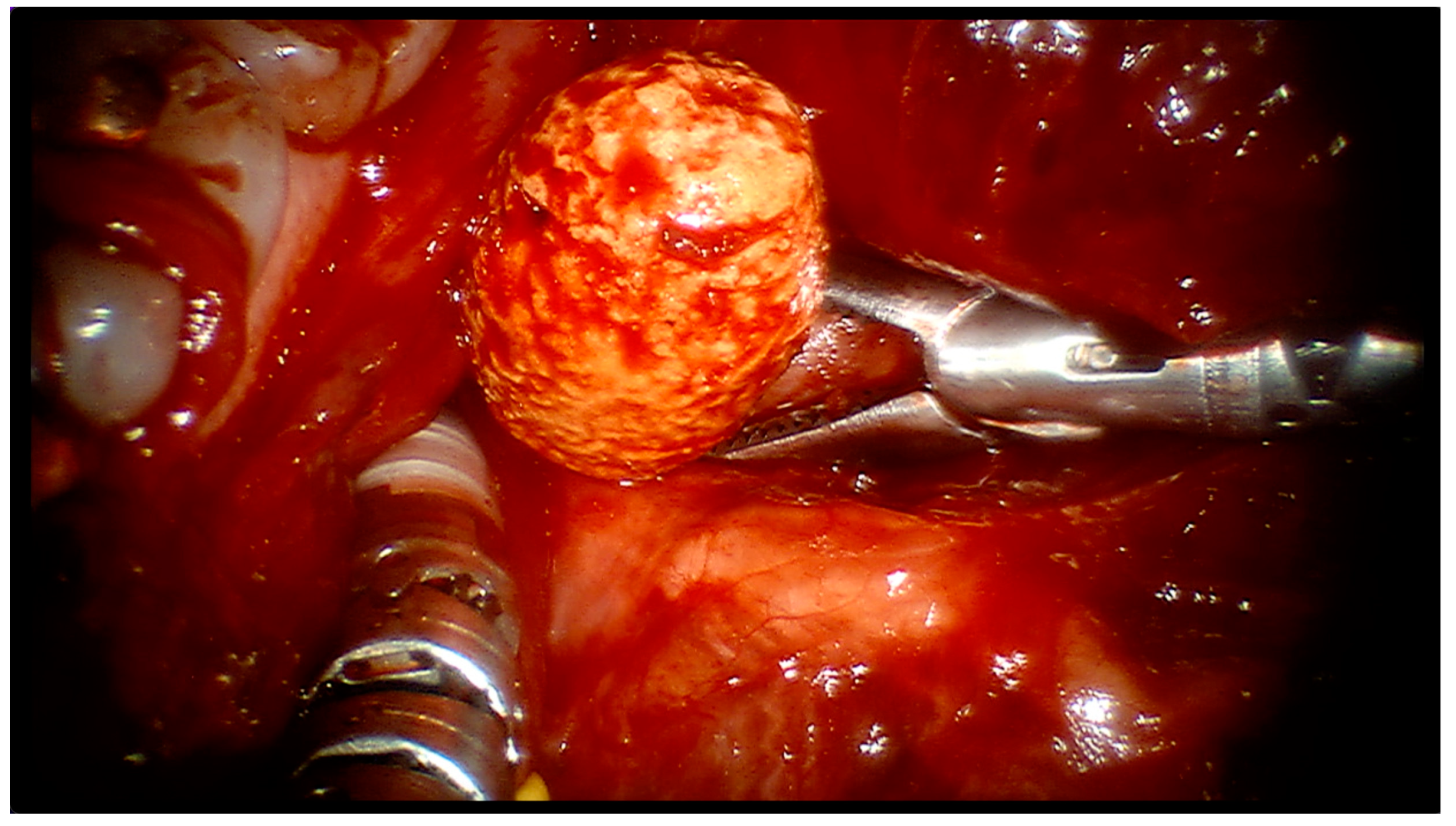 Surgeries 04 00025 g003