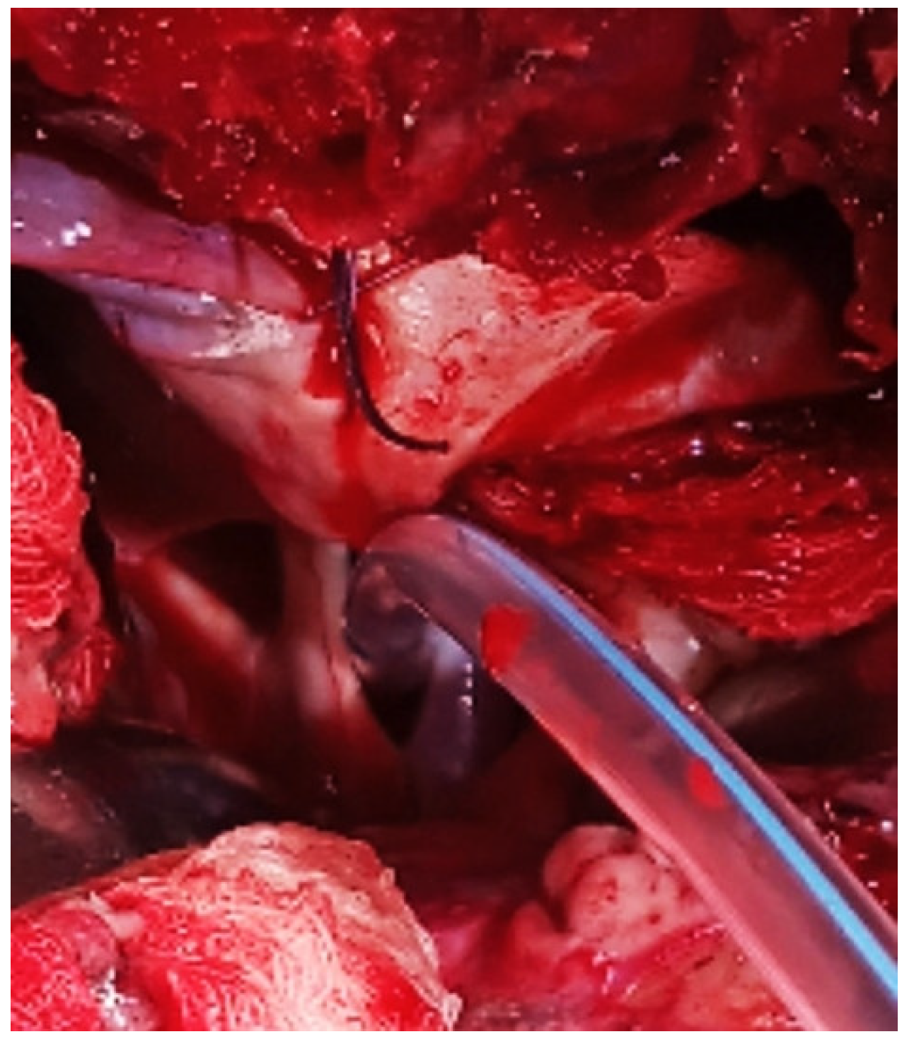 Surgeries 04 00029 g001