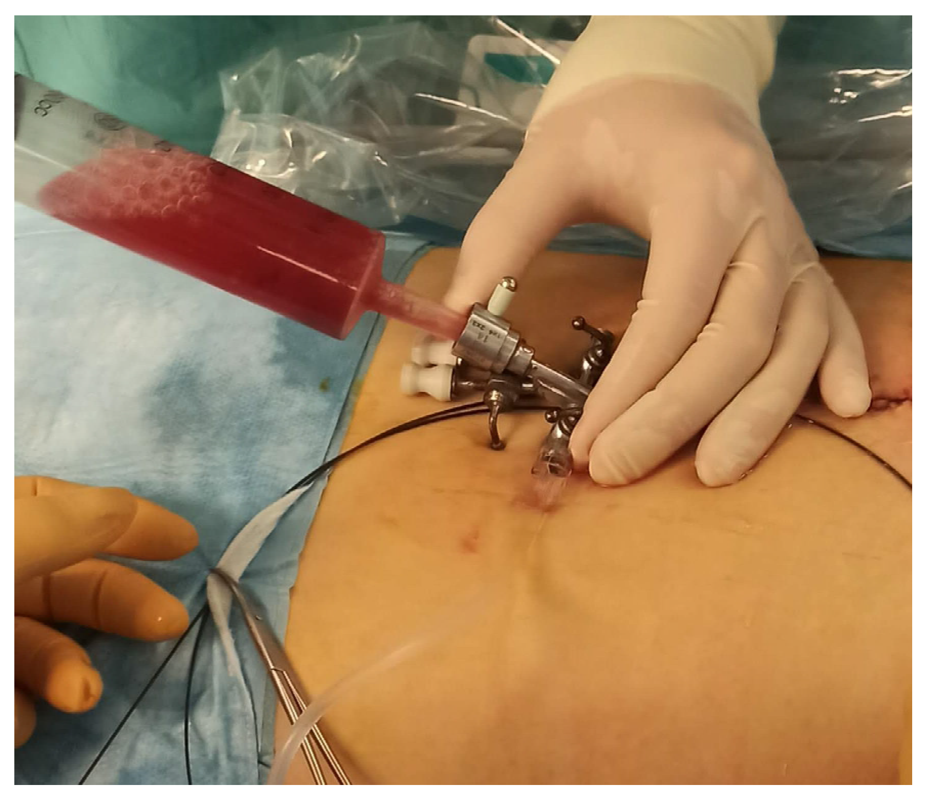 Surgeries 04 00030 g003