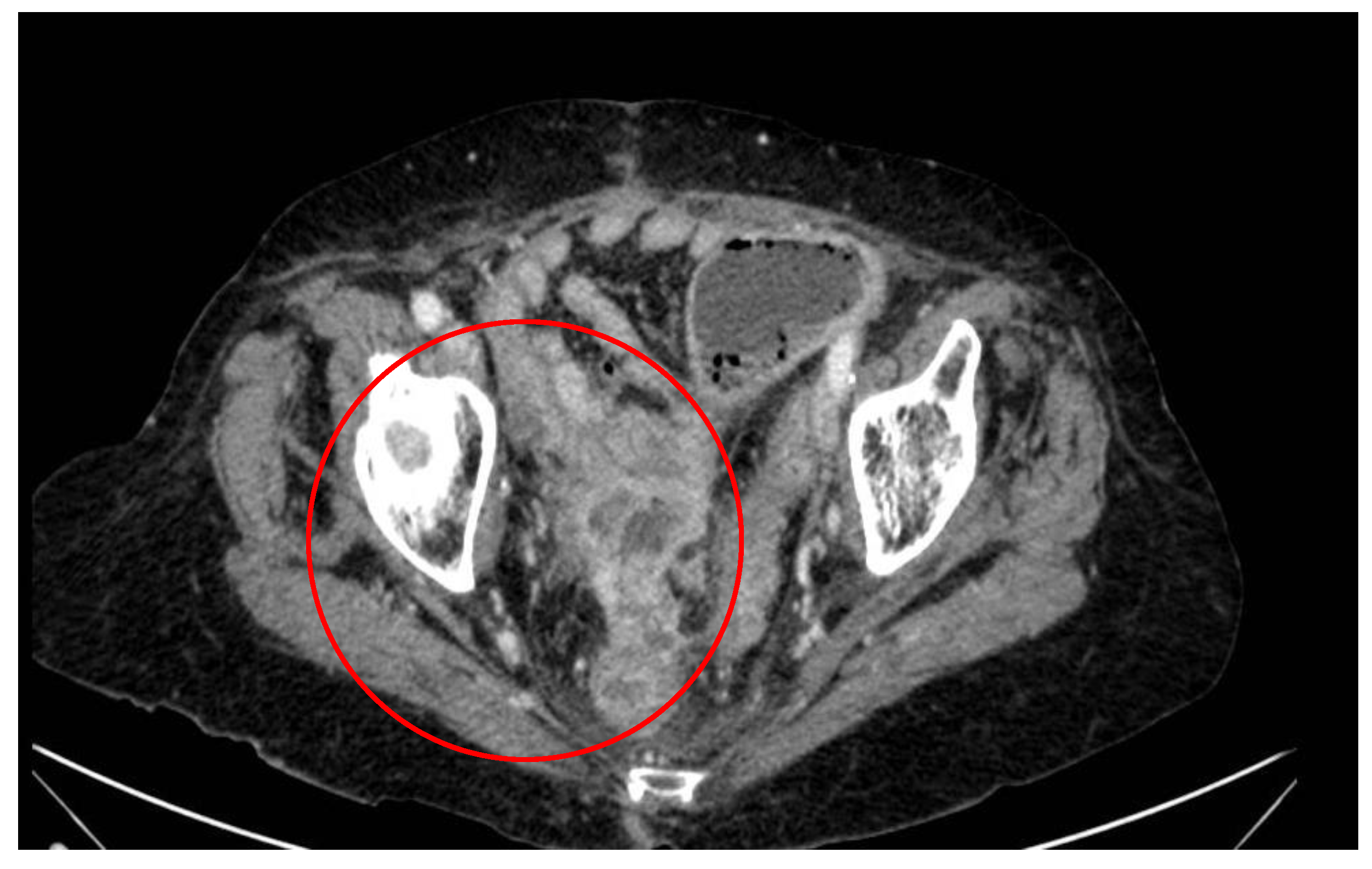 Surgeries 04 00038 g001