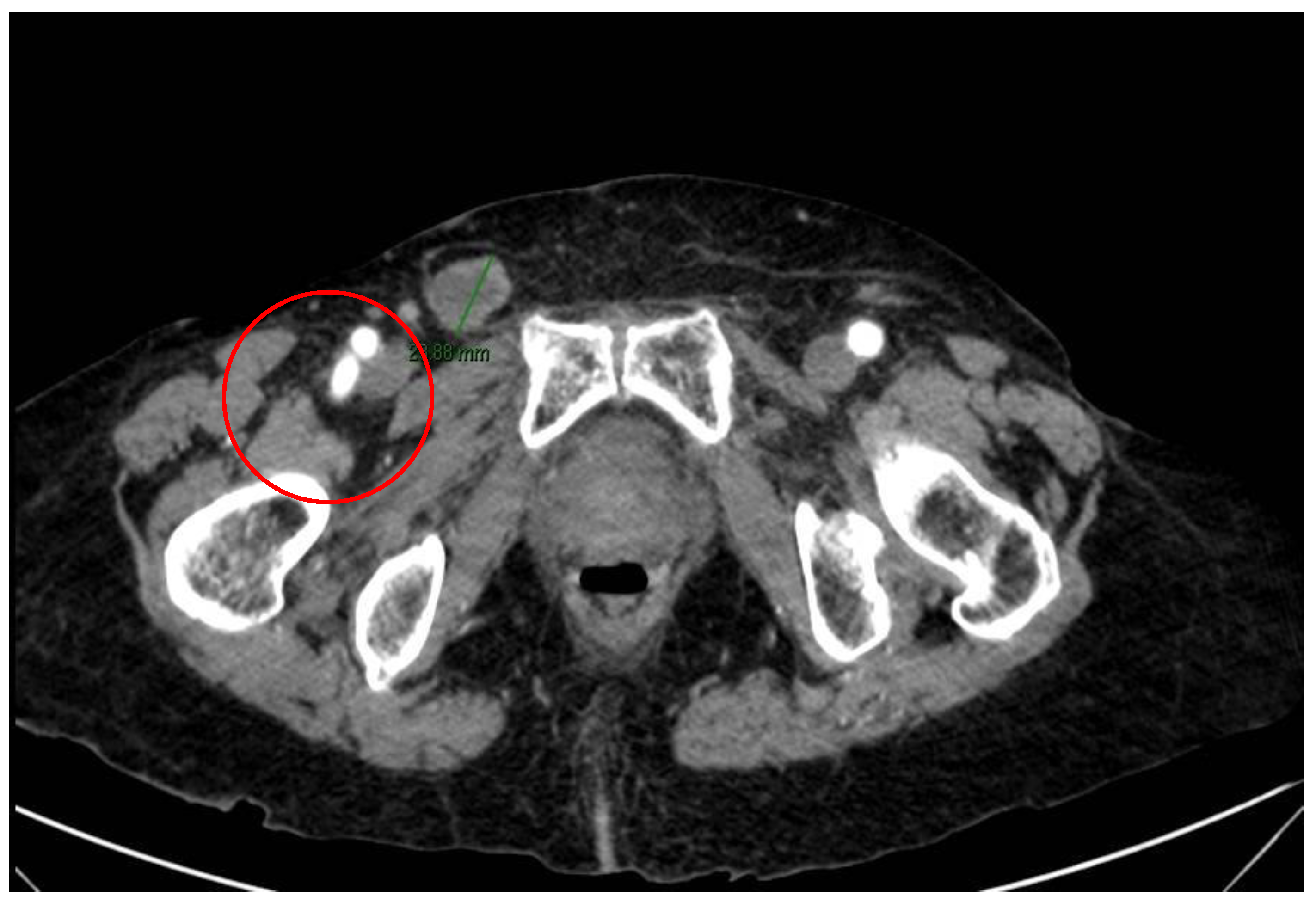 Surgeries 04 00038 g002