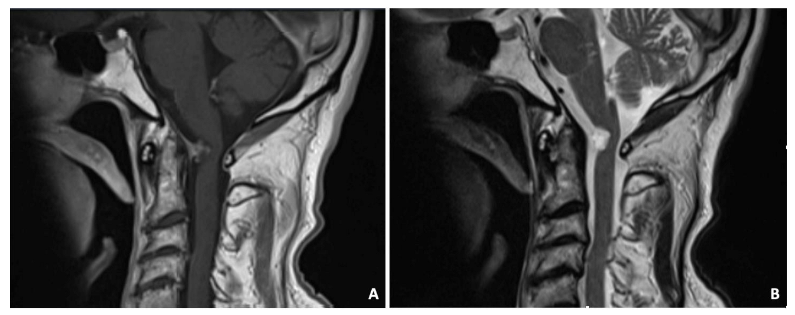 Surgeries 04 00042 g006 Surgeries 04 00042 g006