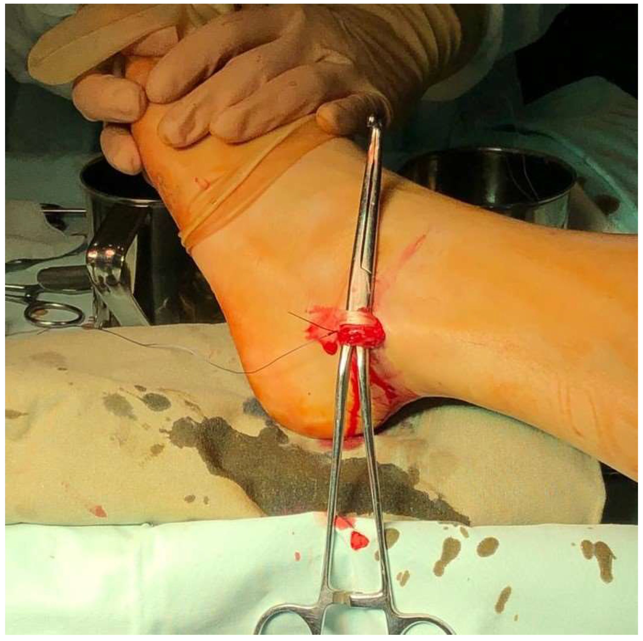 Surgeries 04 00043 g003