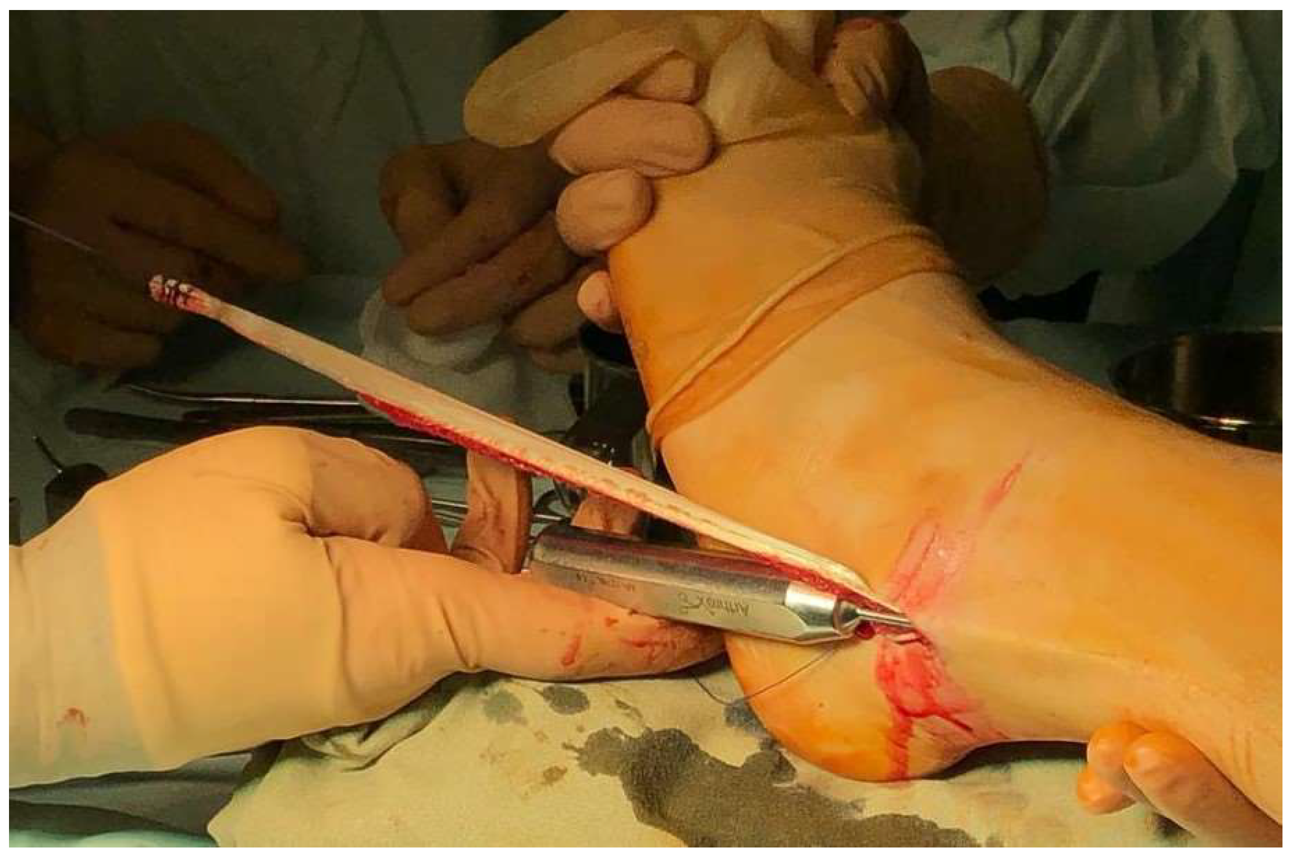 Surgeries 04 00043 g004