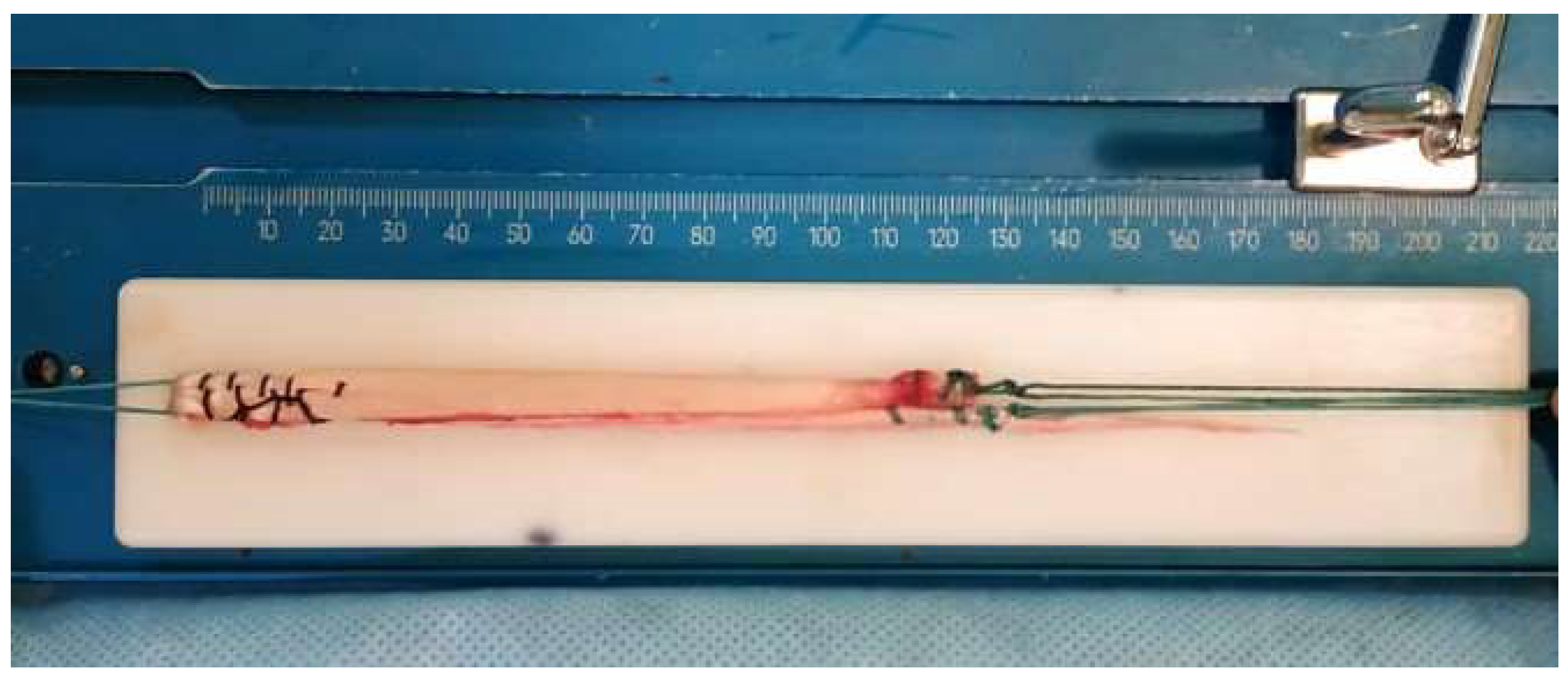 Surgeries 04 00043 g005